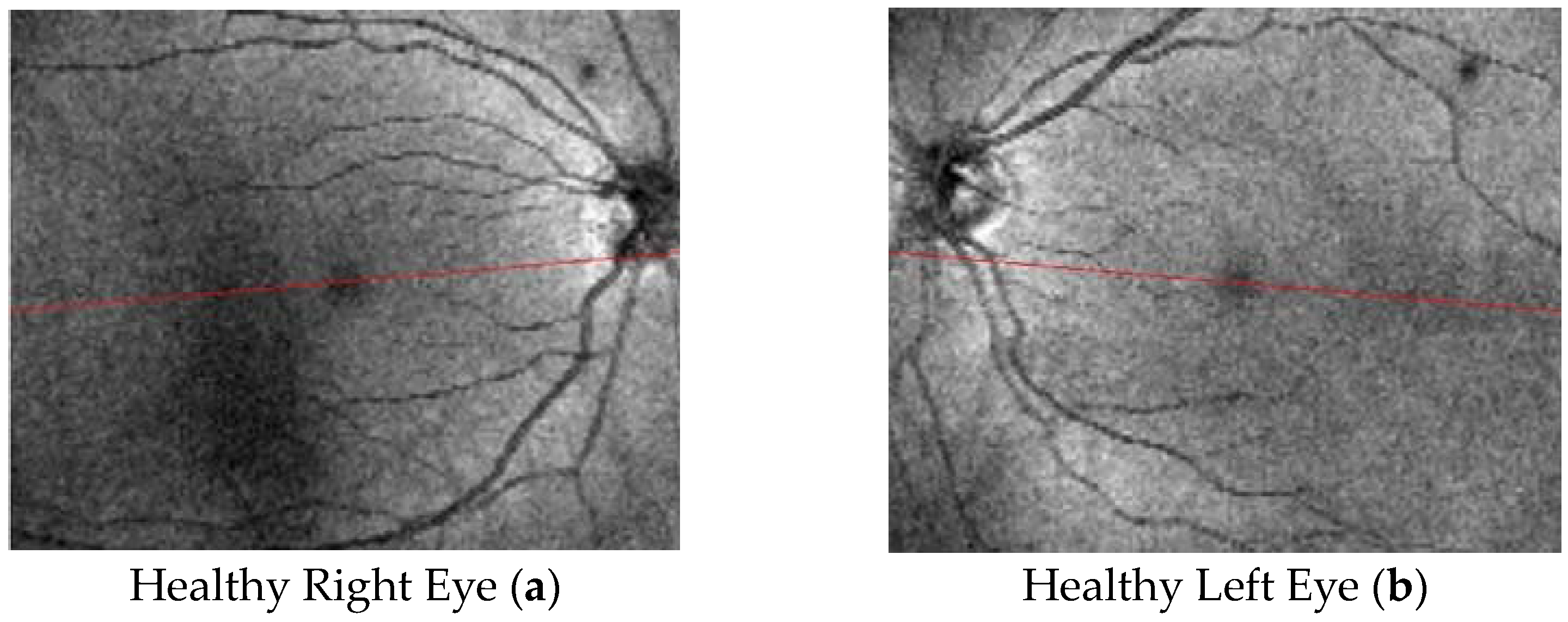 Tomography 10 00037 g003