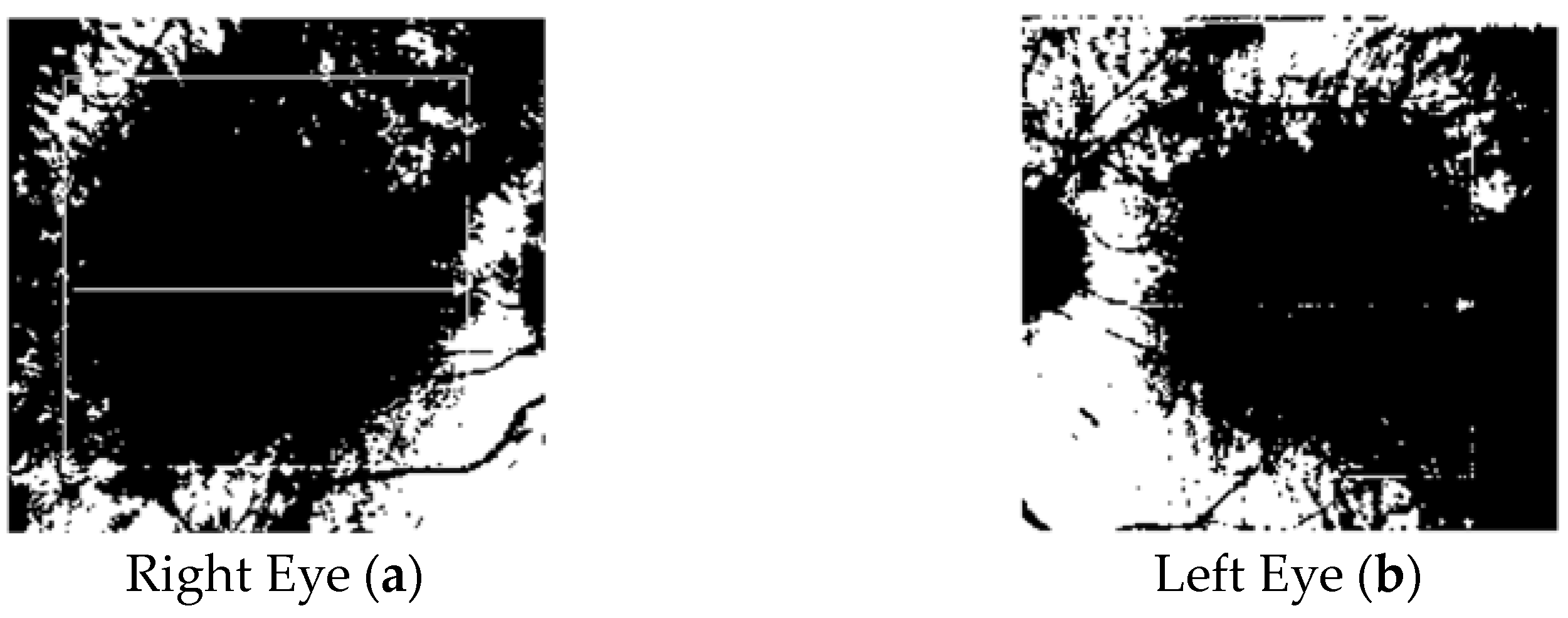 Tomography 10 00037 g005