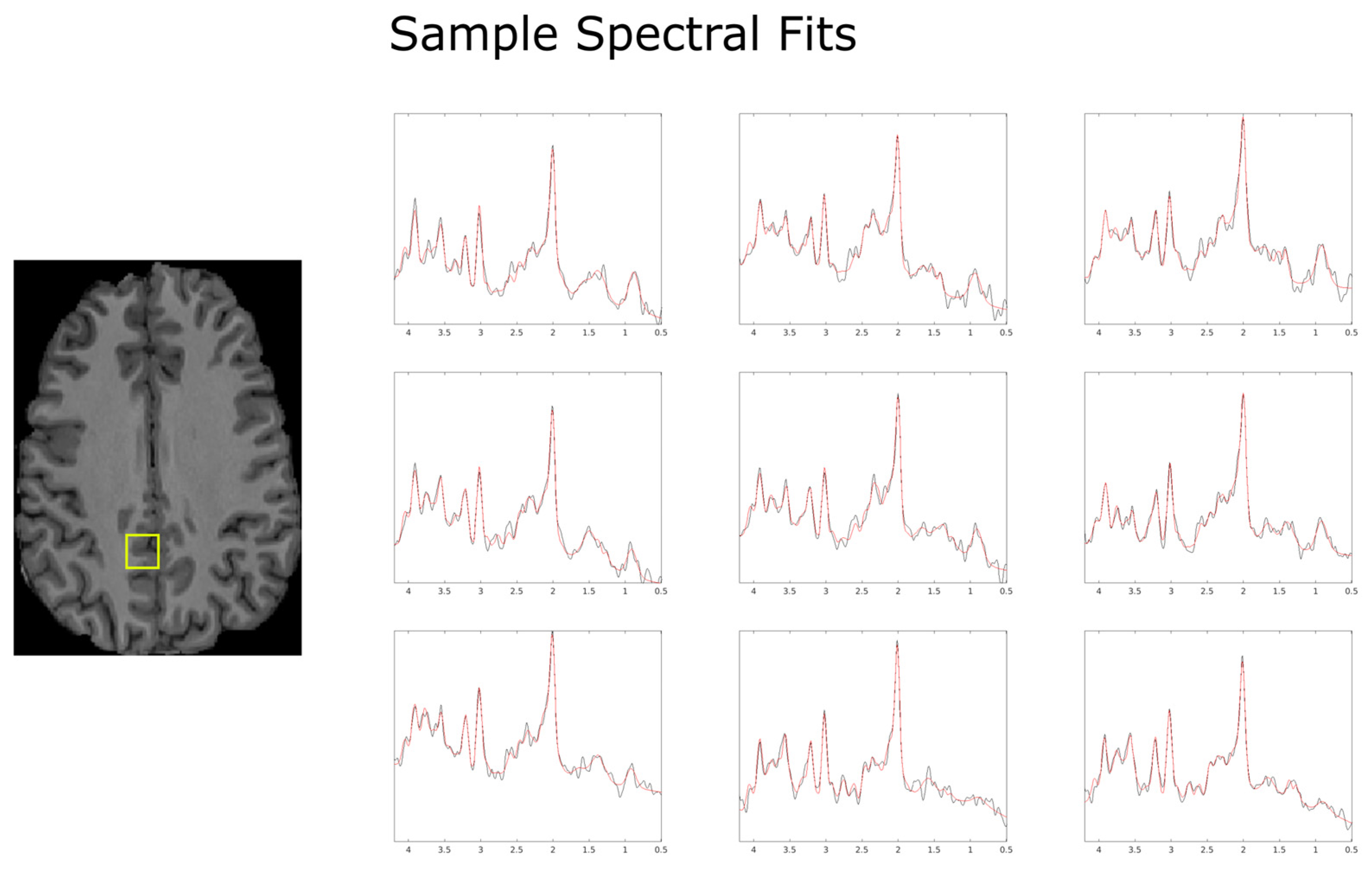 Tomography 10 00038 g004