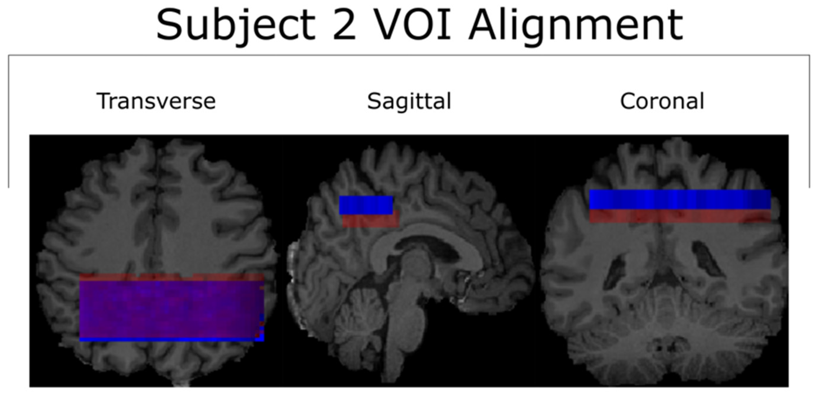 Tomography 10 00038 g005