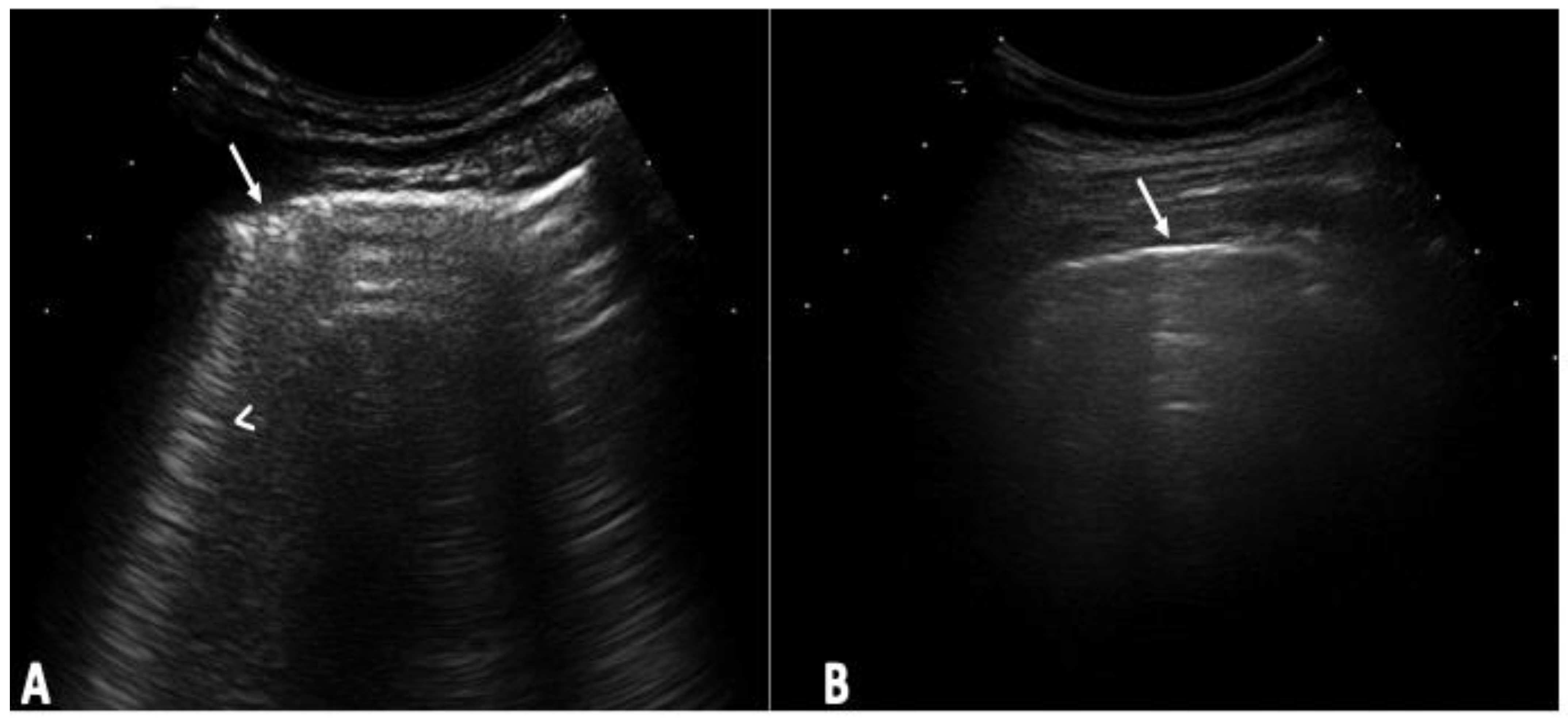 Tomography 10 00041 g001