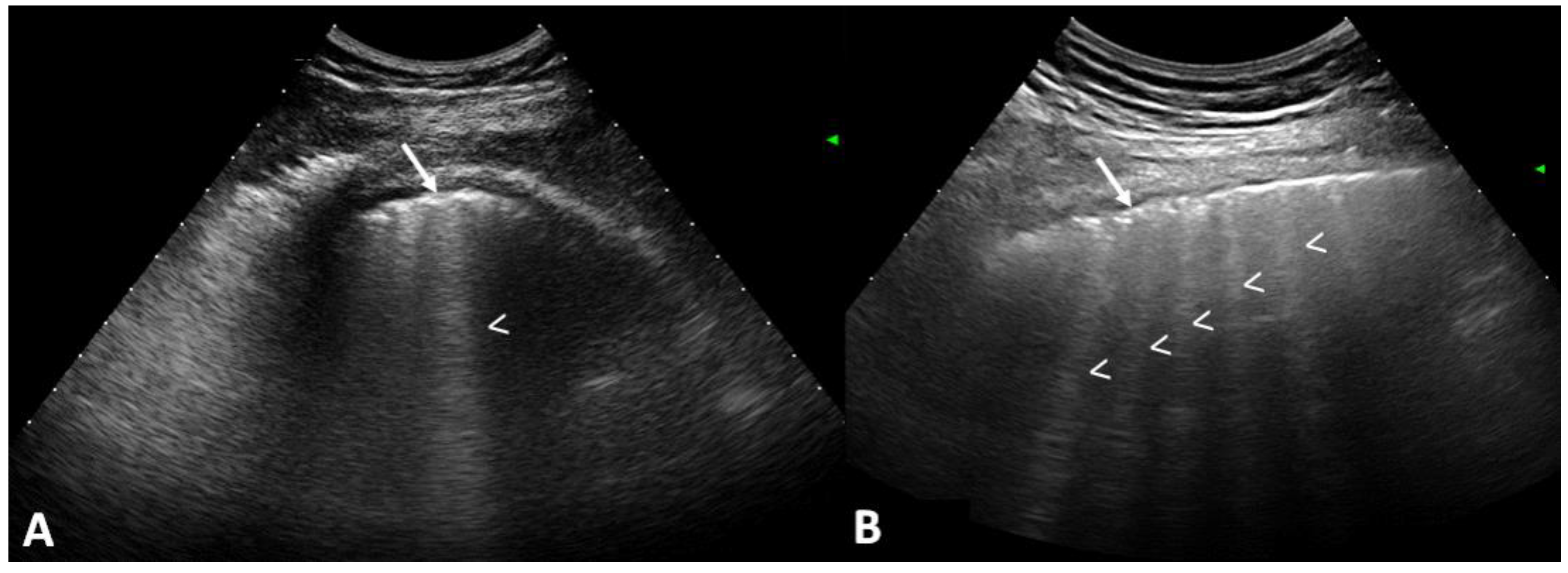 Tomography 10 00041 g002