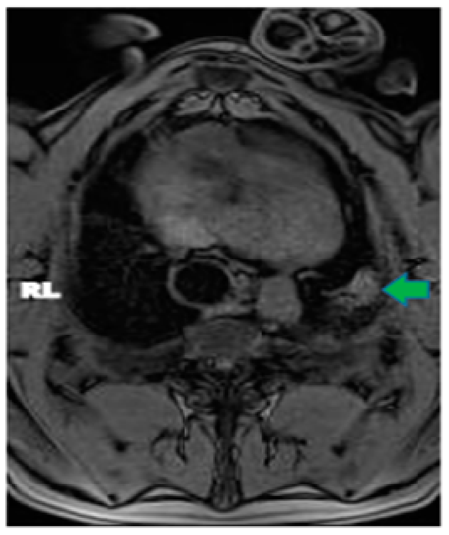 Tomography 10 00042 g002
