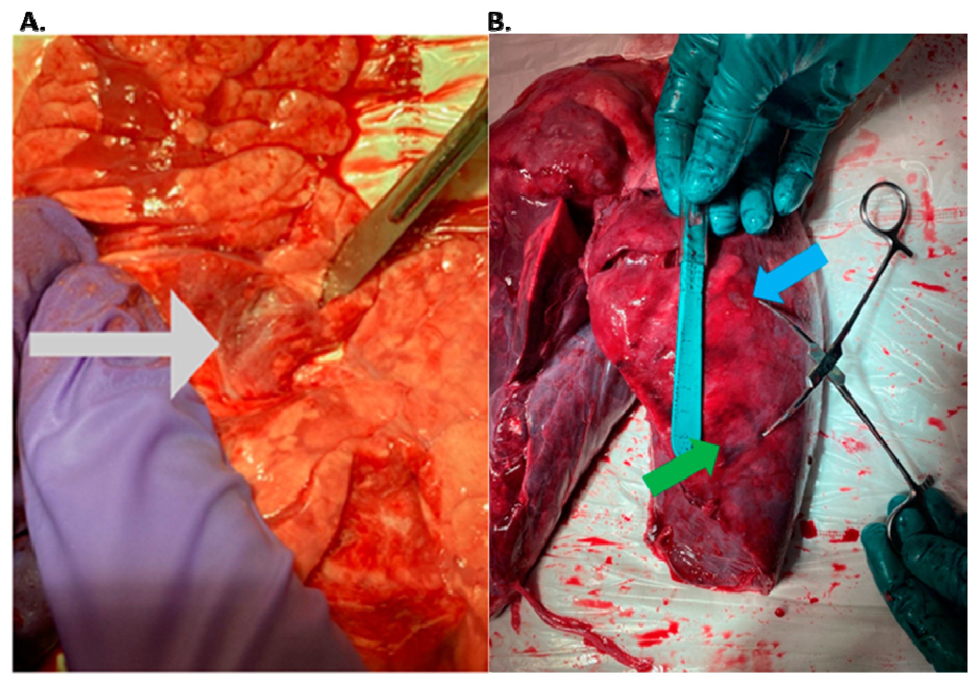 Tomography 10 00042 g003