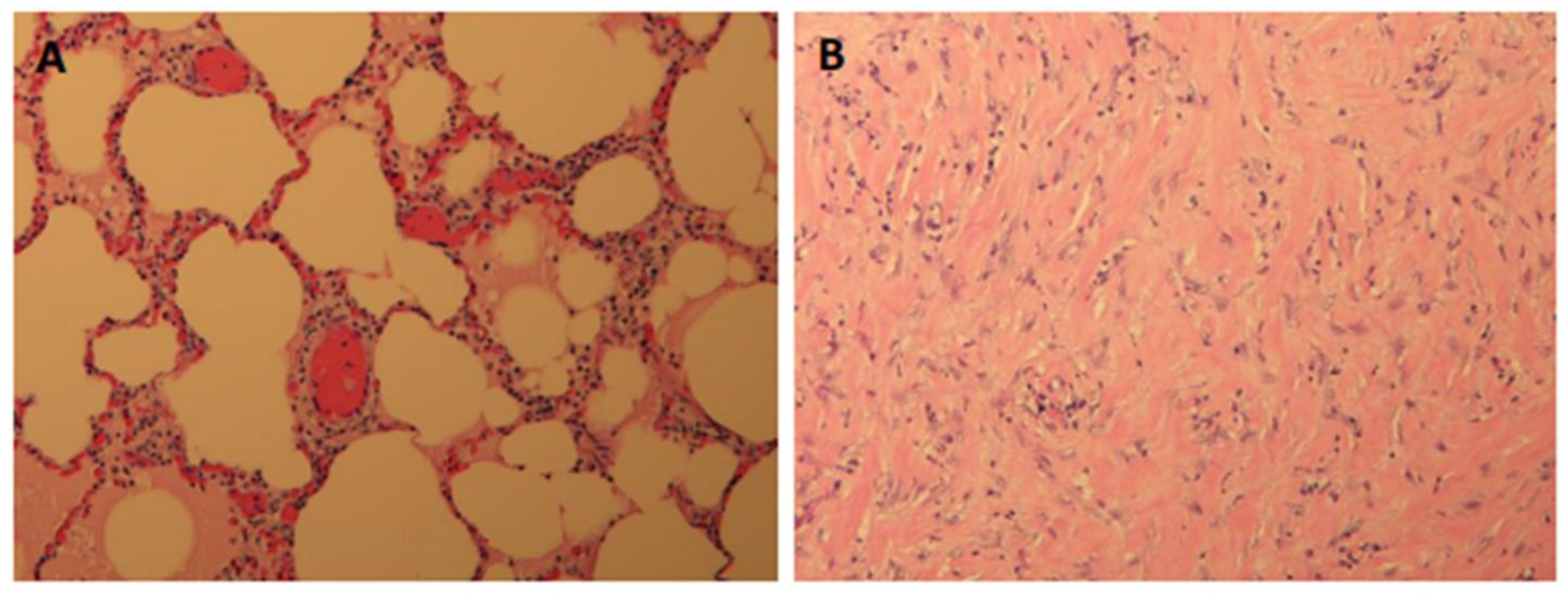 Tomography 10 00042 g004