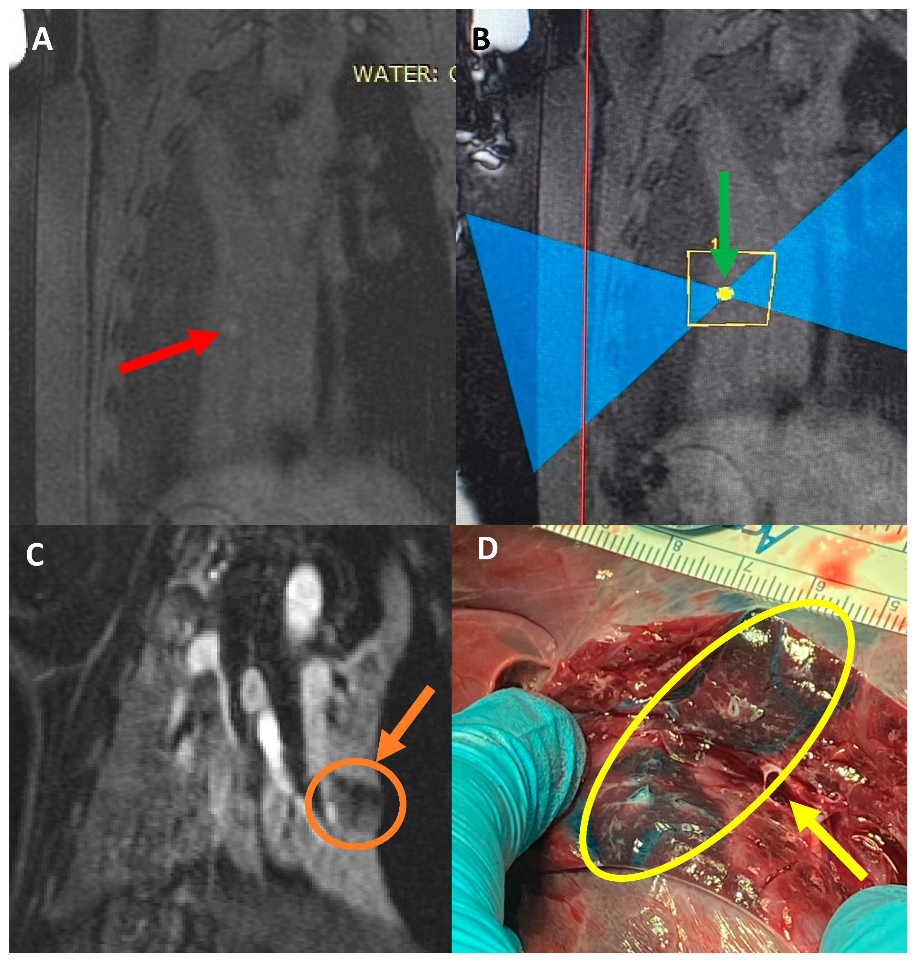Tomography 10 00042 g005