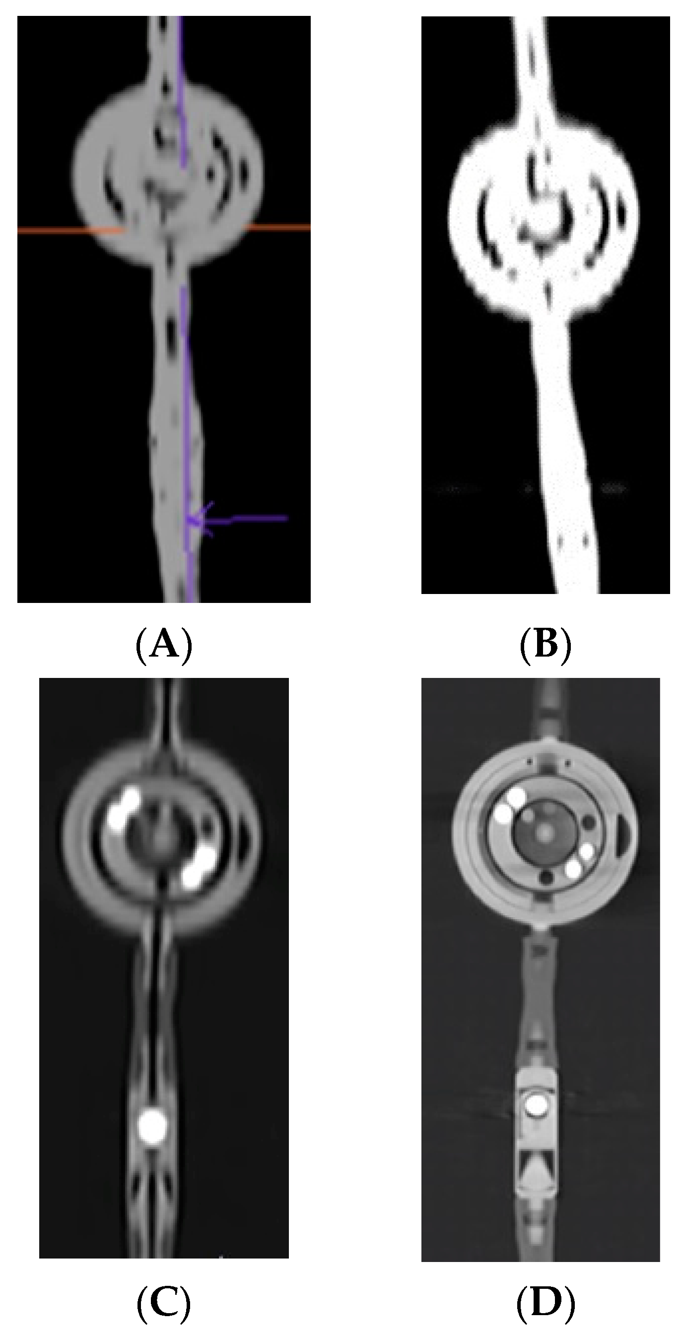 Tomography 10 00043 g002 Tomography 10 00043 g002