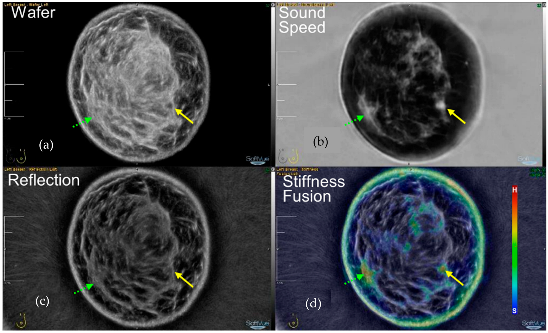 Tomography 10 00044 g005