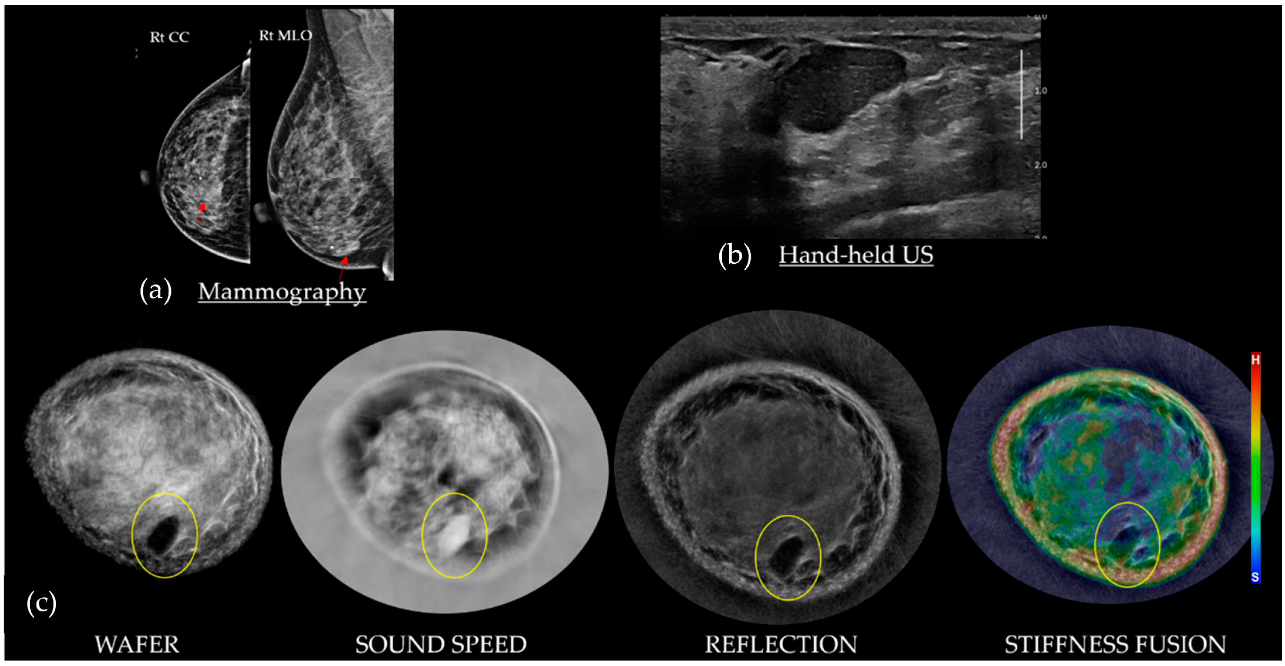 Tomography 10 00044 g007