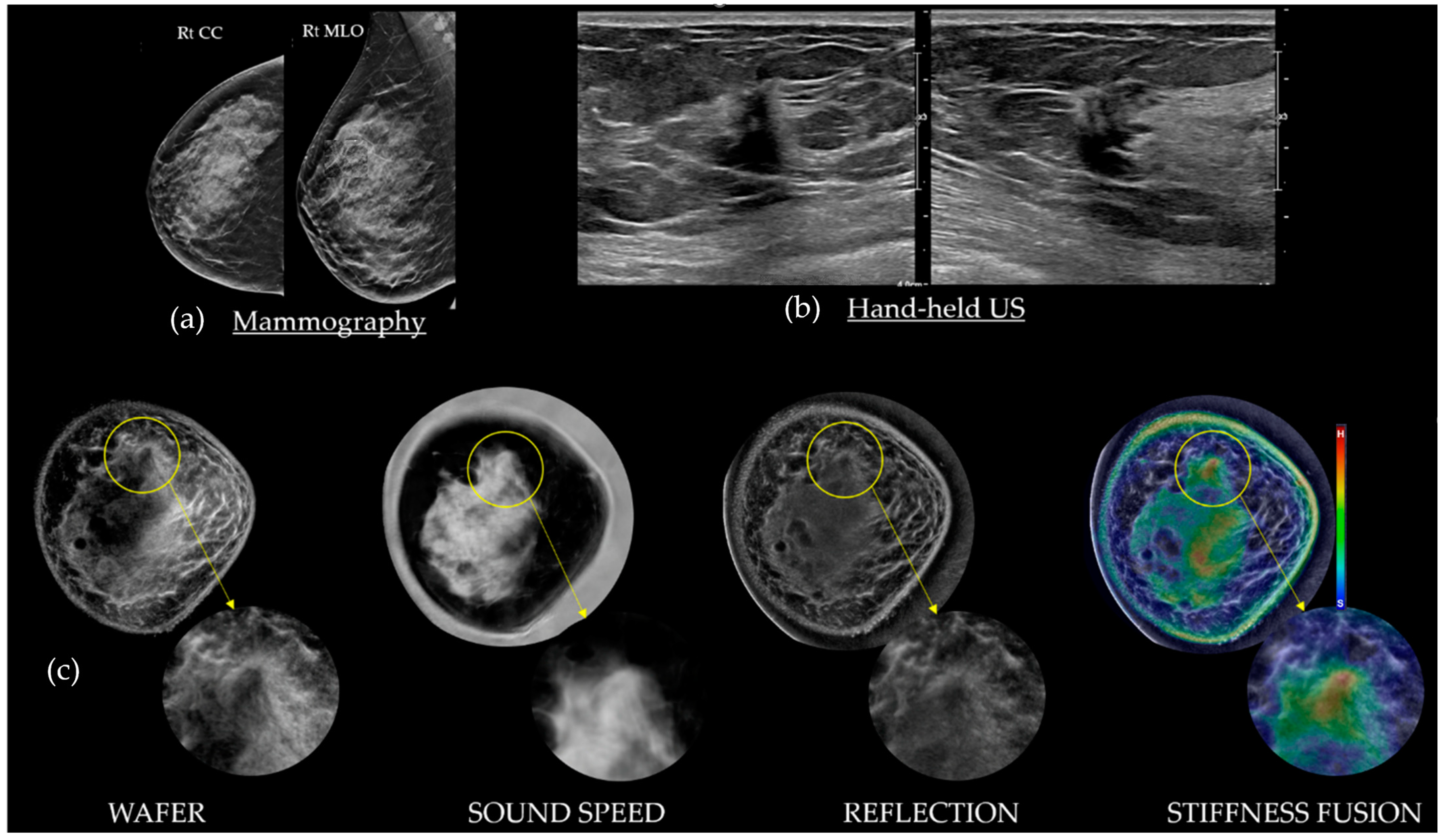 Tomography 10 00044 g008