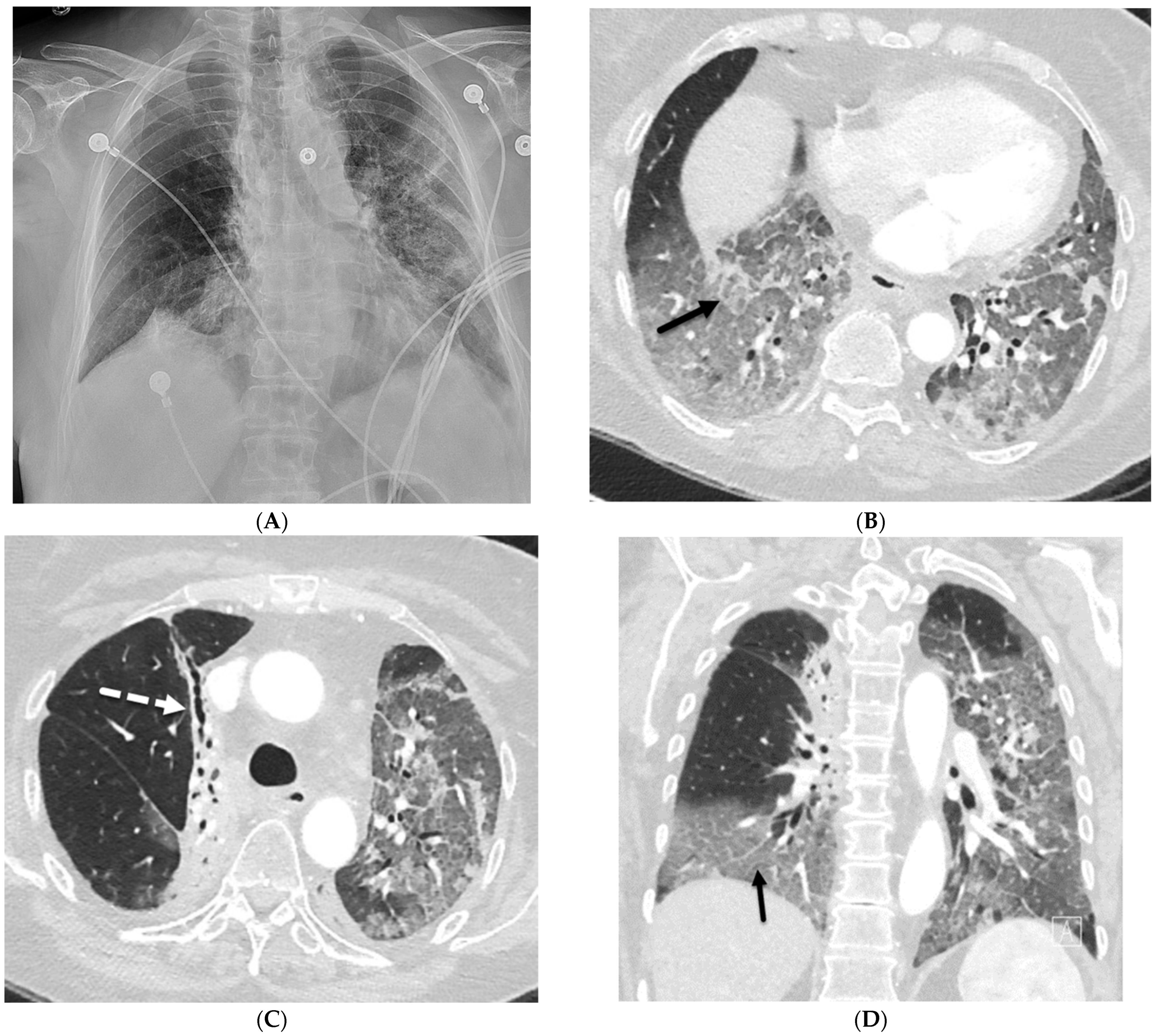 Tomography 10 00045 g001 Tomography 10 00045 g001