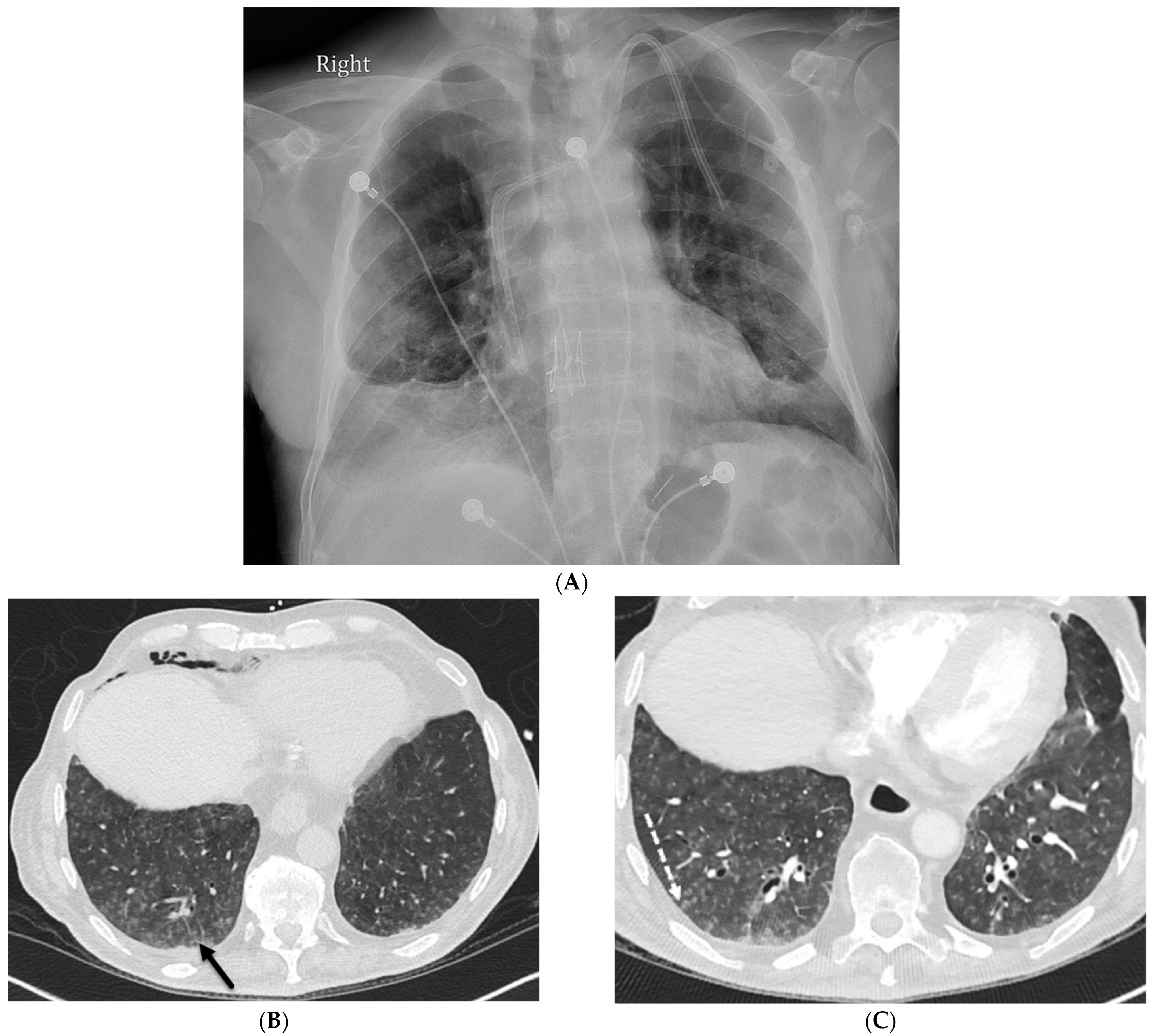 Tomography 10 00045 g002 Tomography 10 00045 g002