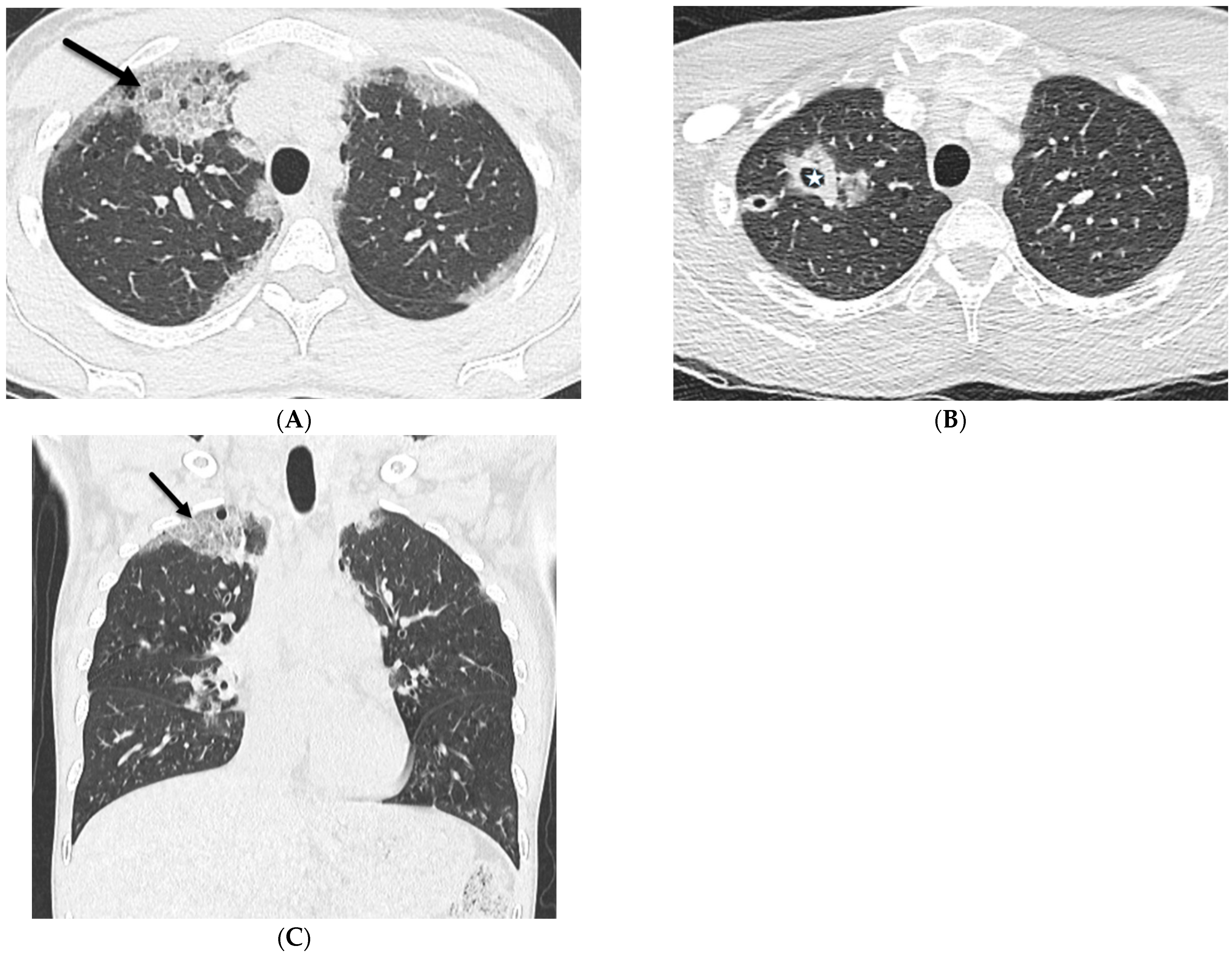 Tomography 10 00045 g003 Tomography 10 00045 g003