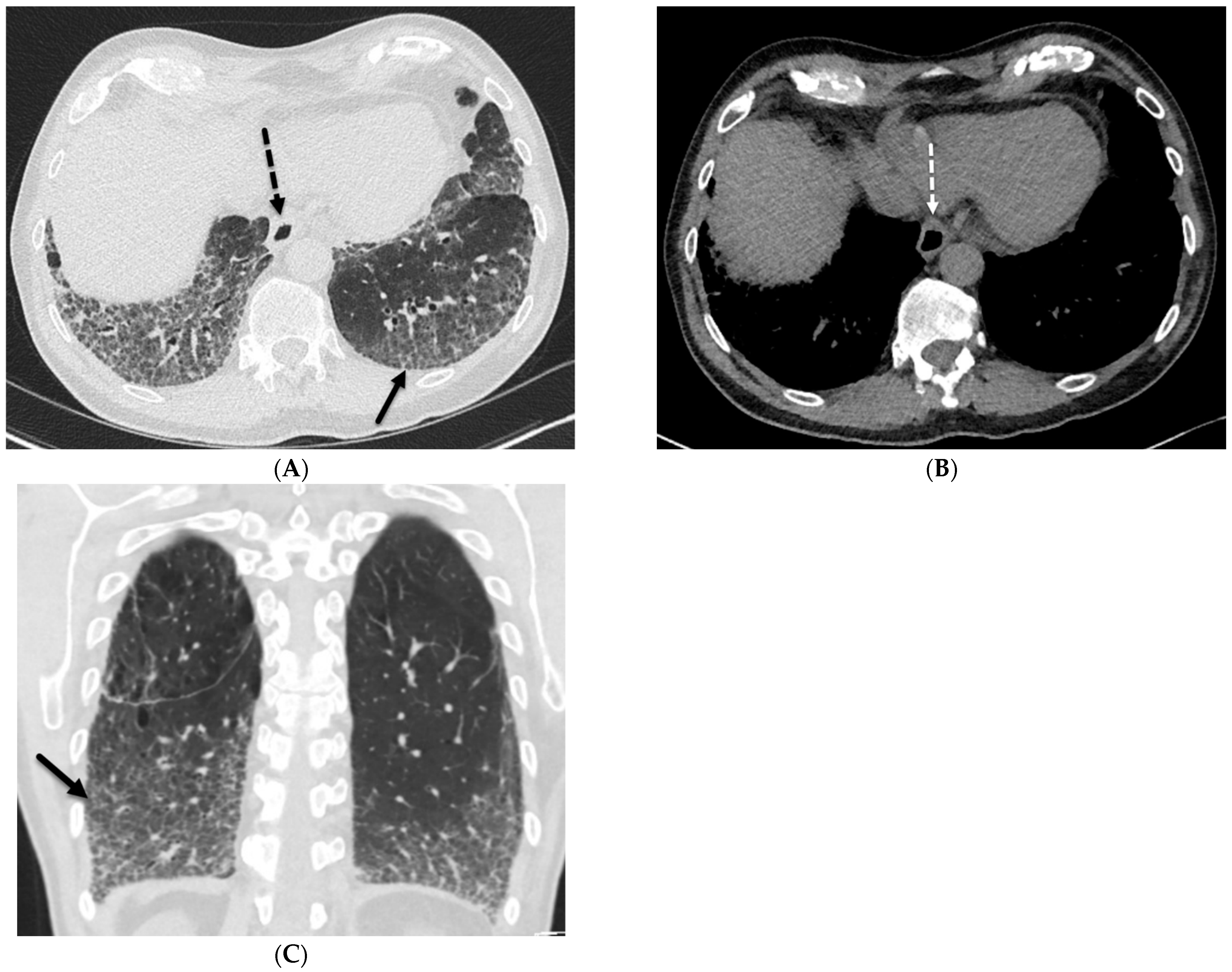 Tomography 10 00045 g004 Tomography 10 00045 g004