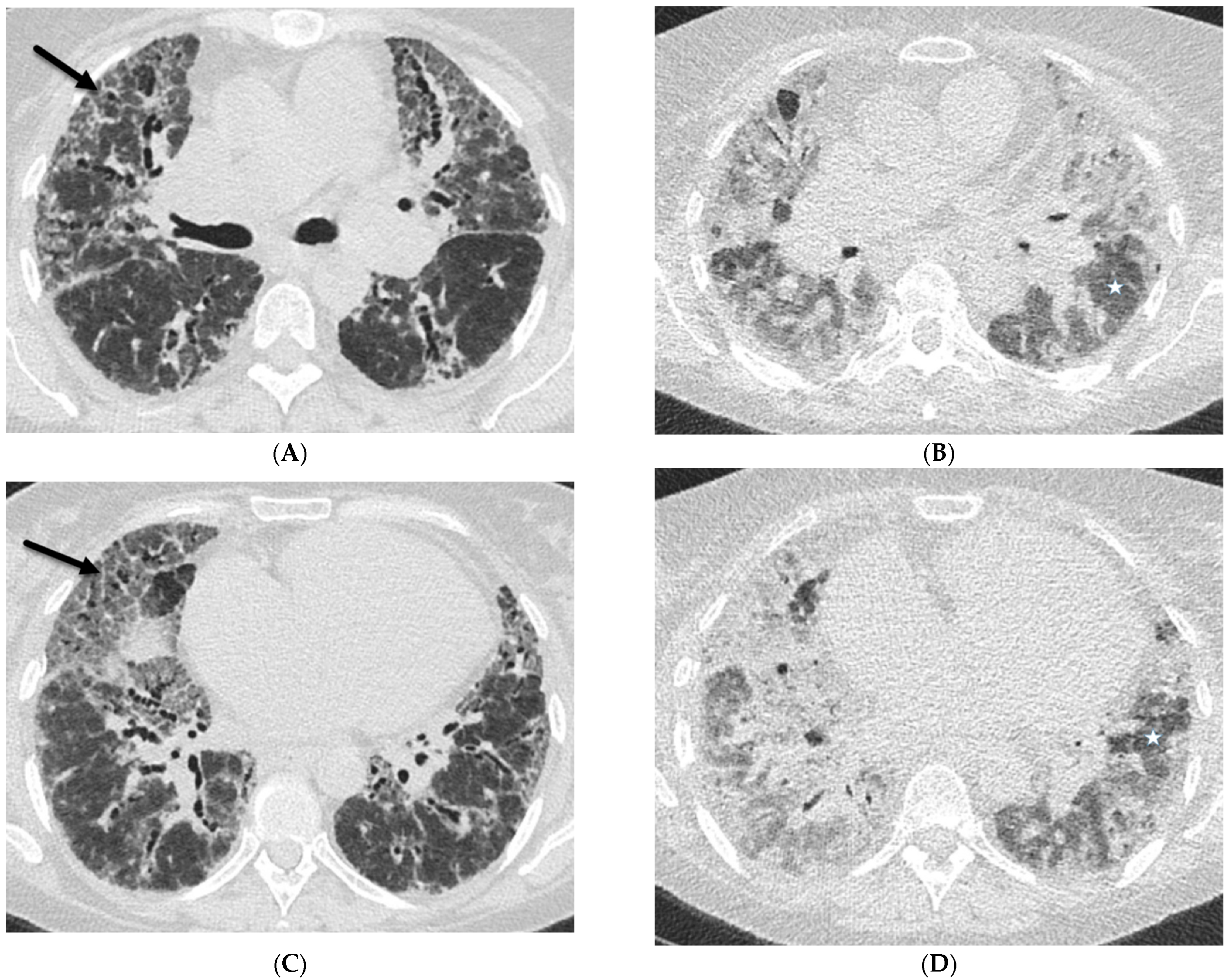 Tomography 10 00045 g005 Tomography 10 00045 g005