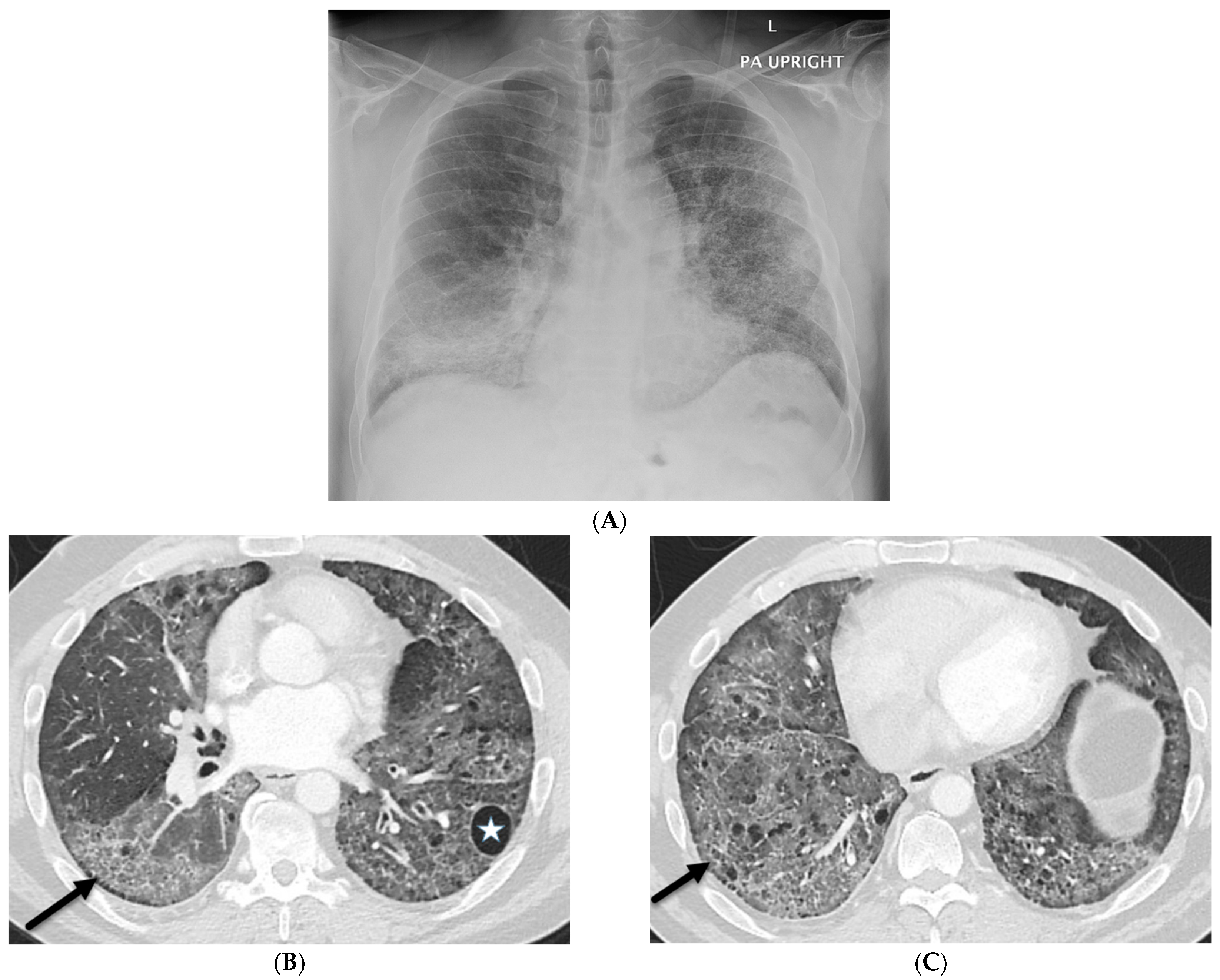 Tomography 10 00045 g006 Tomography 10 00045 g006