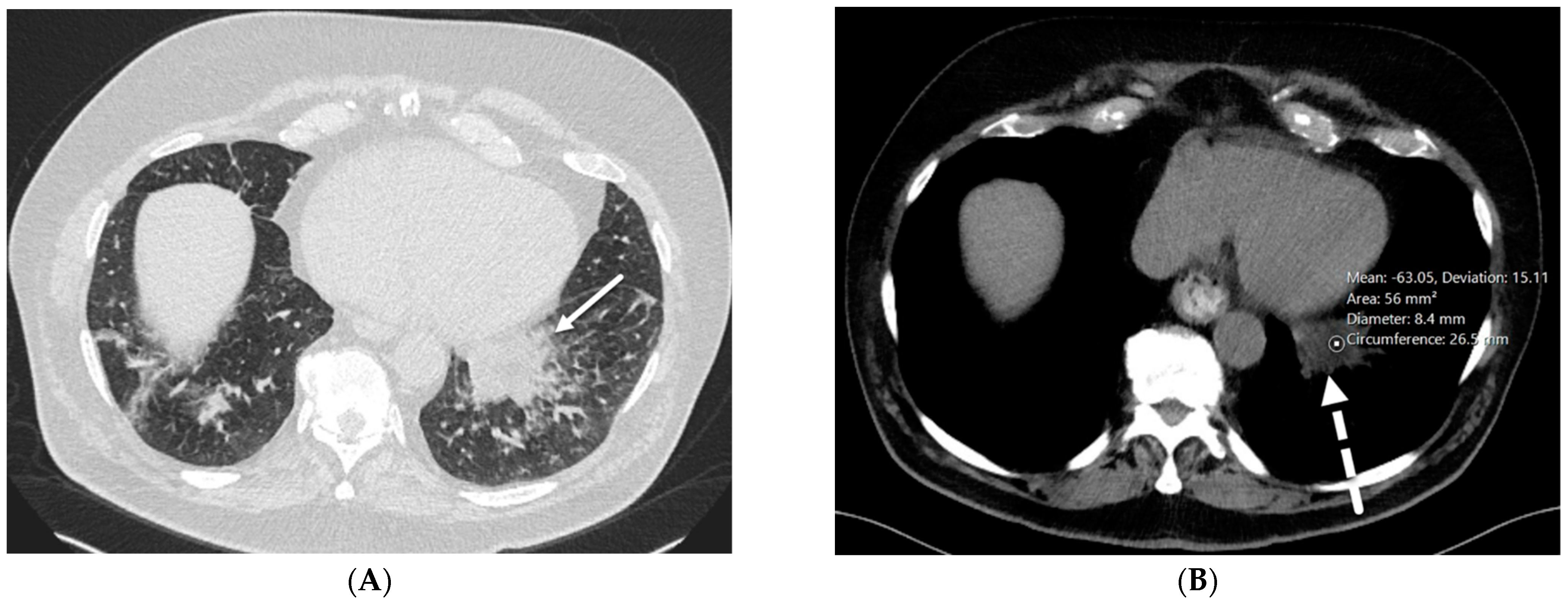 Tomography 10 00045 g007 Tomography 10 00045 g007