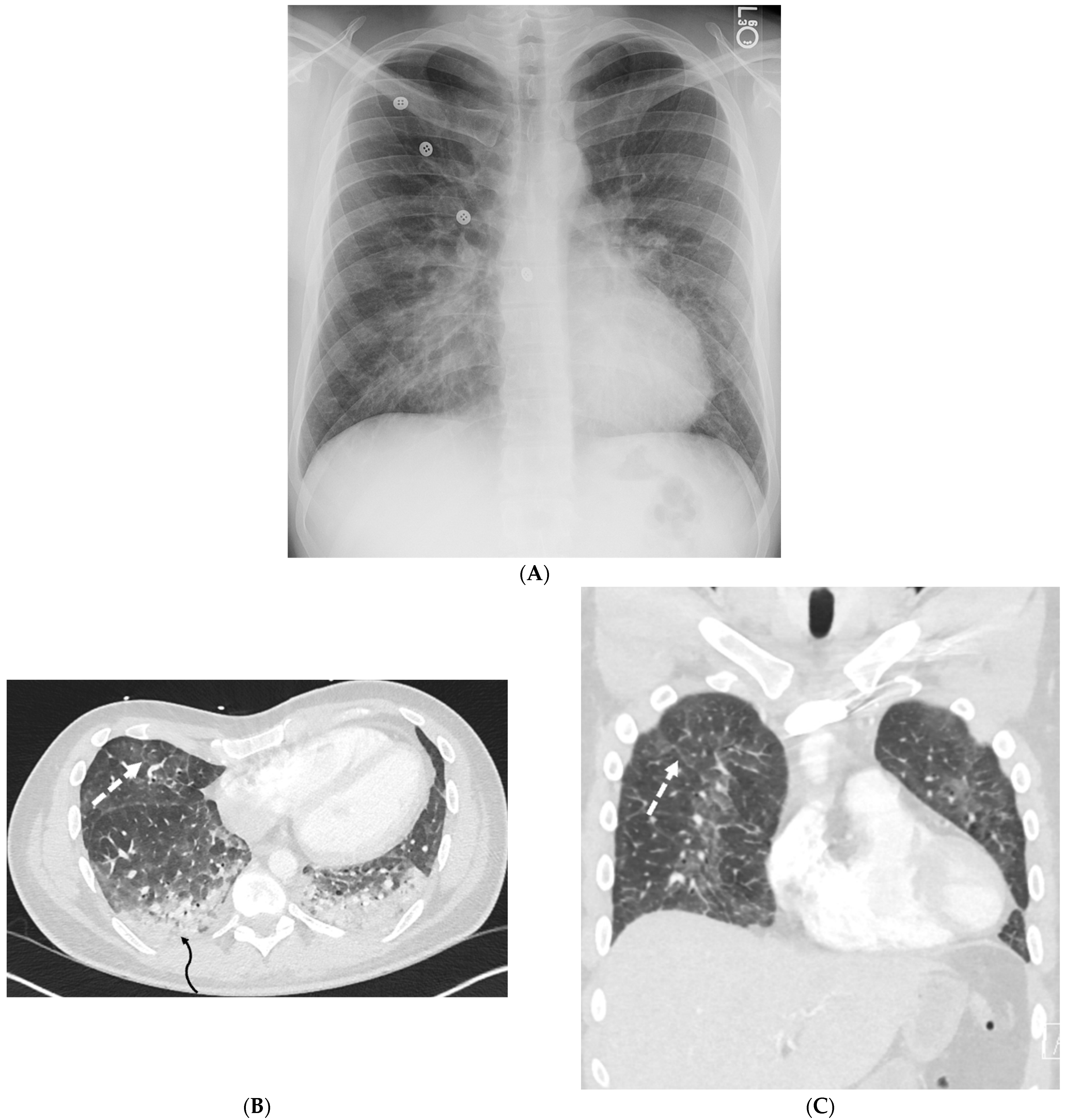 Tomography 10 00045 g009 Tomography 10 00045 g009