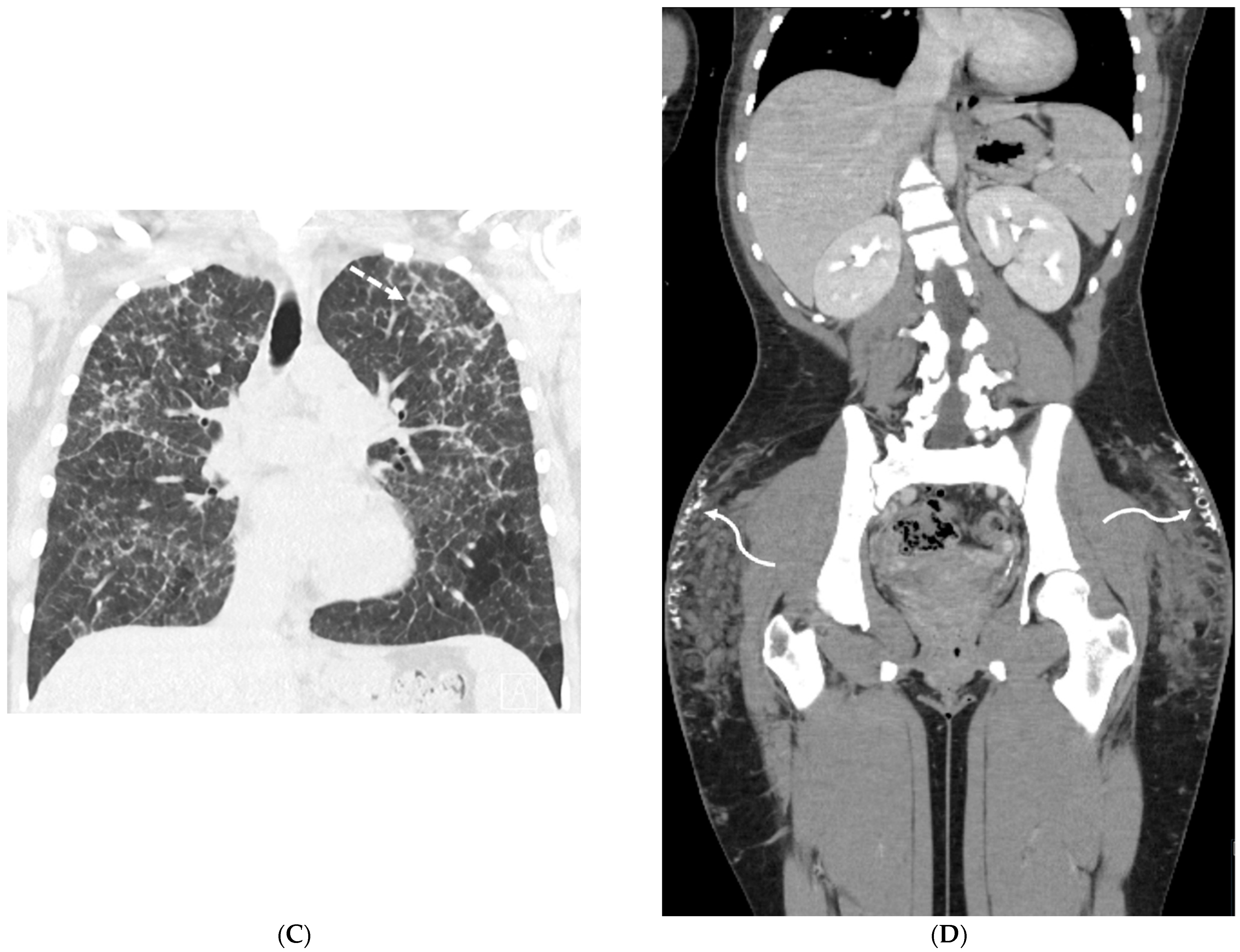 Tomography 10 00045 g010b Tomography 10 00045 g010b