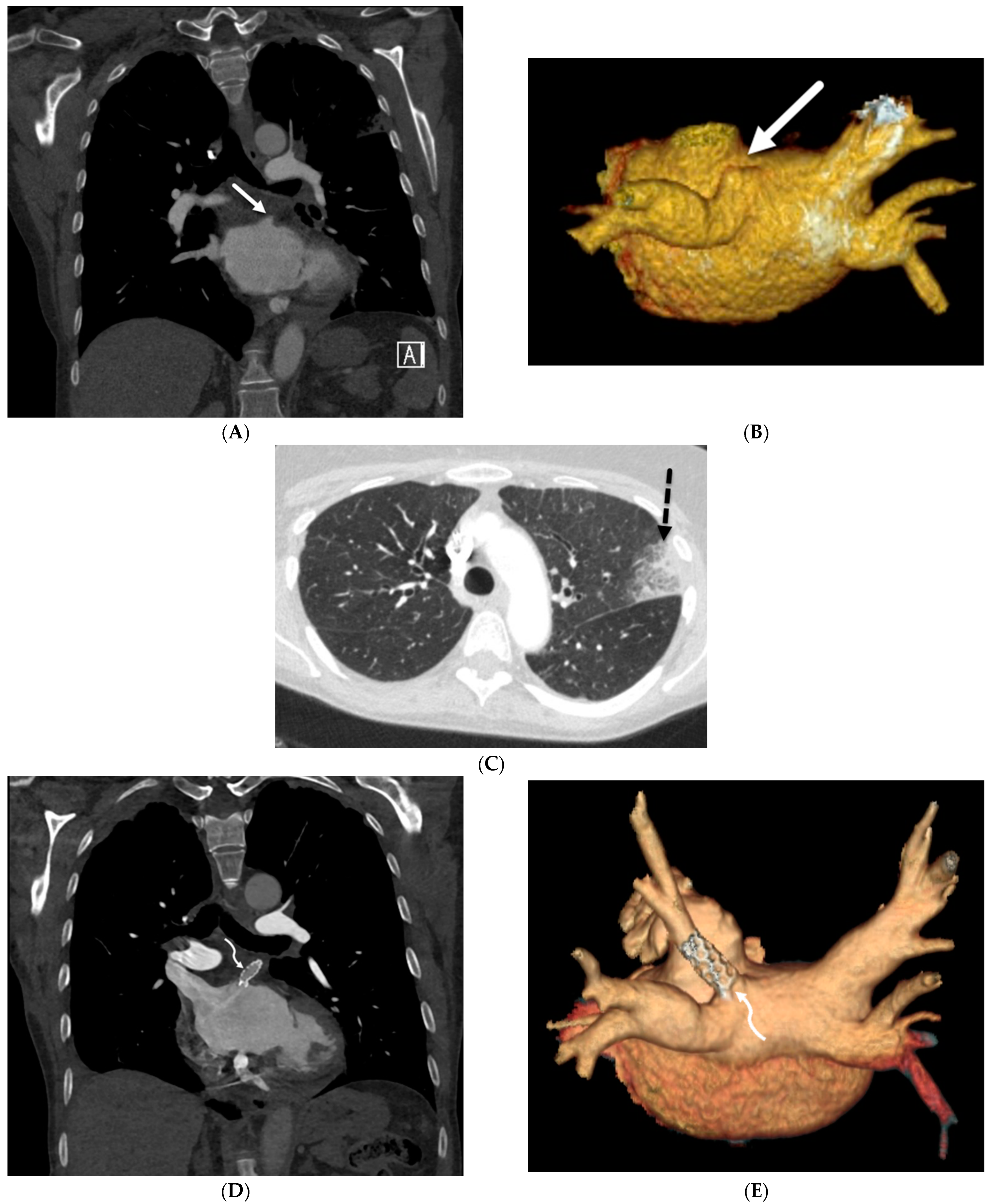Tomography 10 00045 g011 Tomography 10 00045 g011