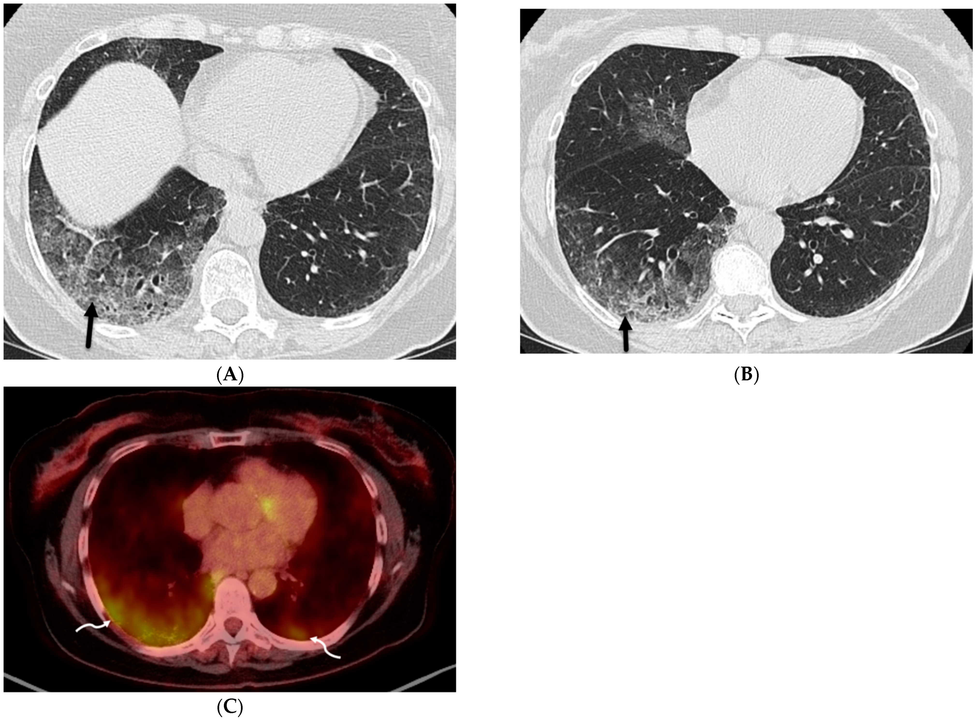 Tomography 10 00045 g012 Tomography 10 00045 g012