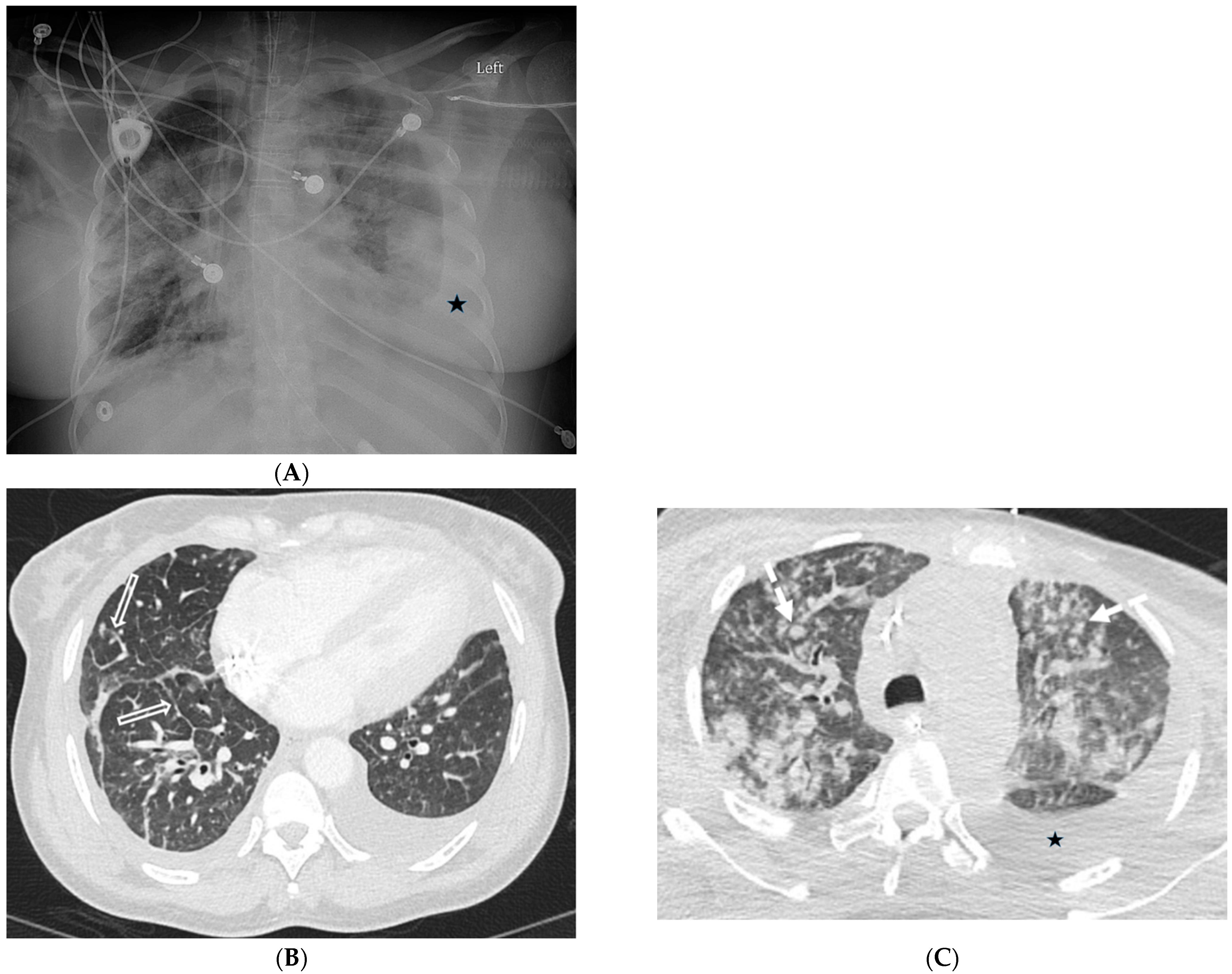 Tomography 10 00045 g013 Tomography 10 00045 g013