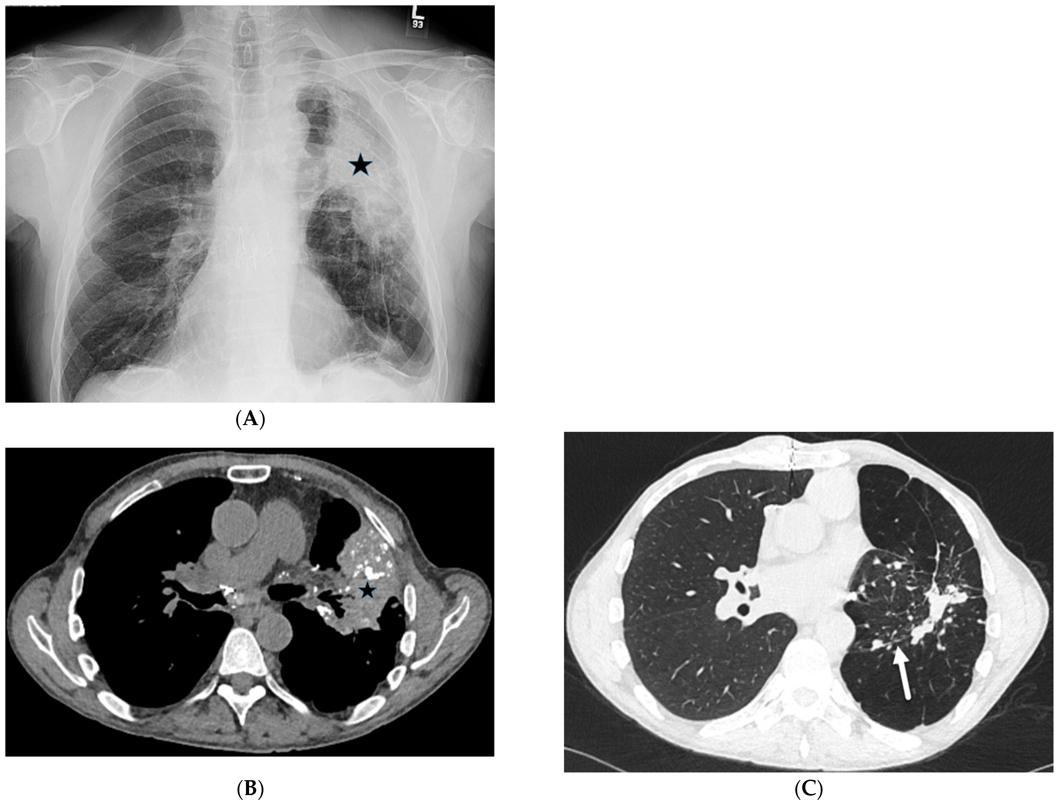 Tomography 10 00045 g014 Tomography 10 00045 g014