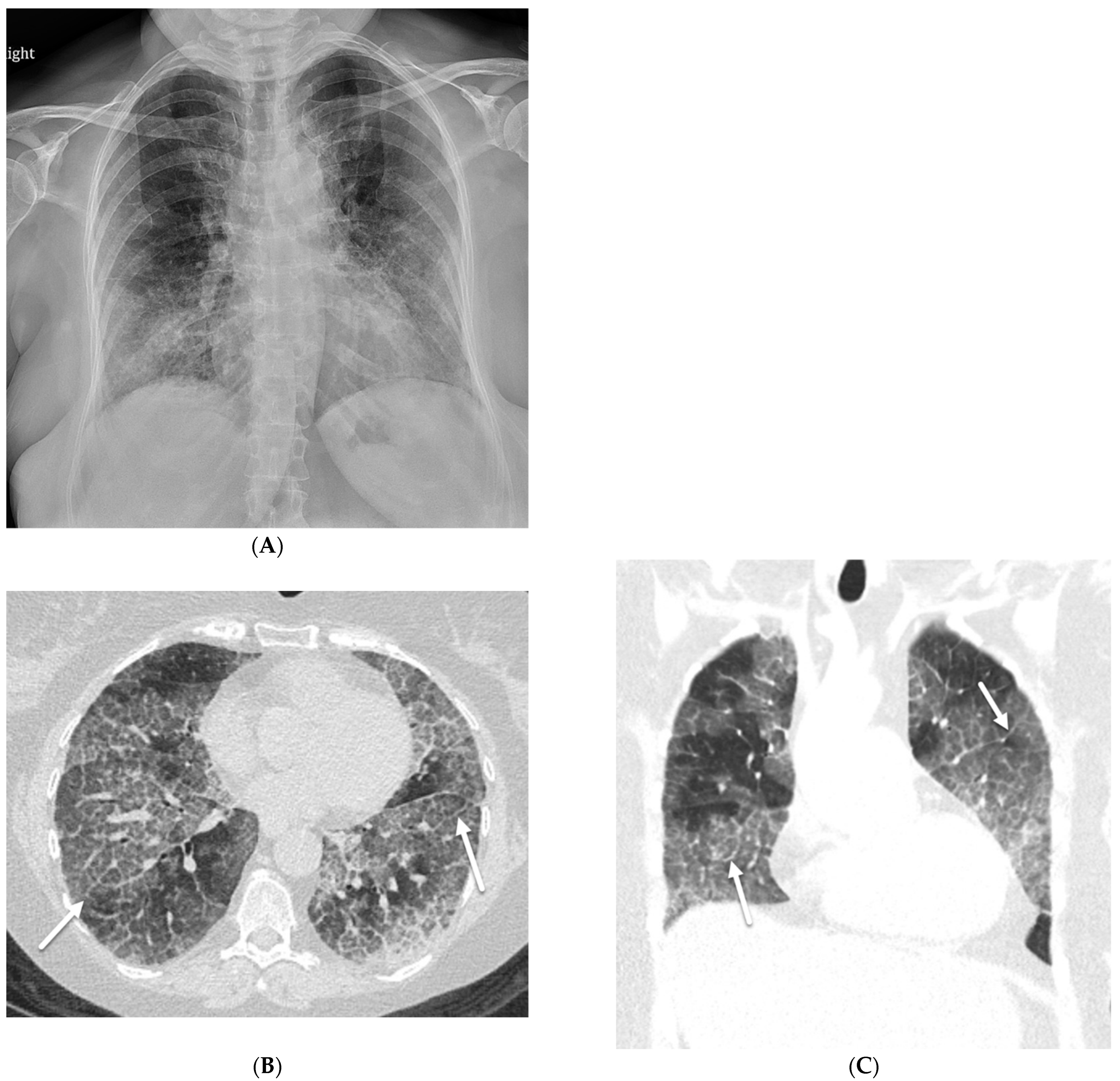 Tomography 10 00045 g015 Tomography 10 00045 g015