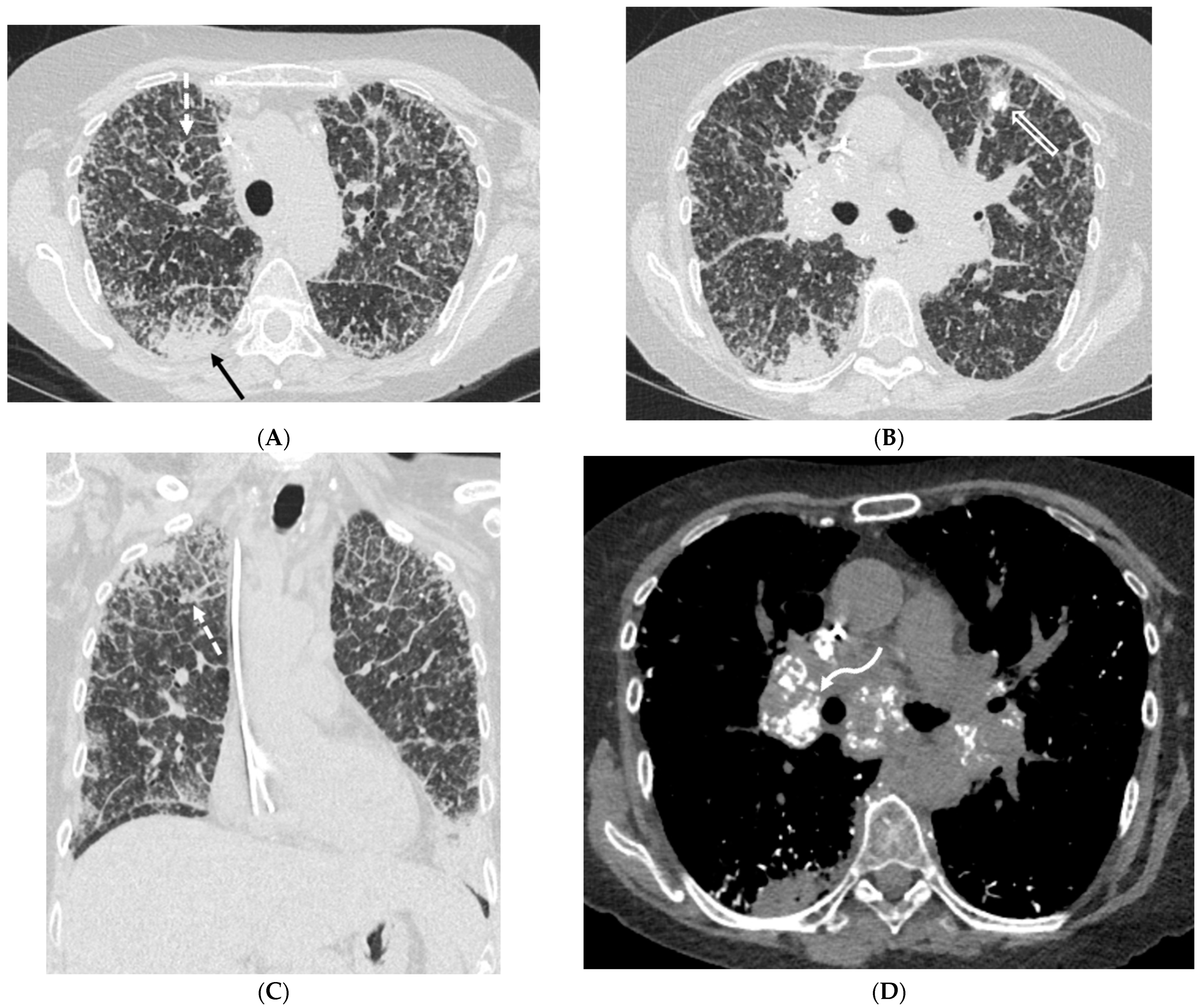 Tomography 10 00045 g016 Tomography 10 00045 g016