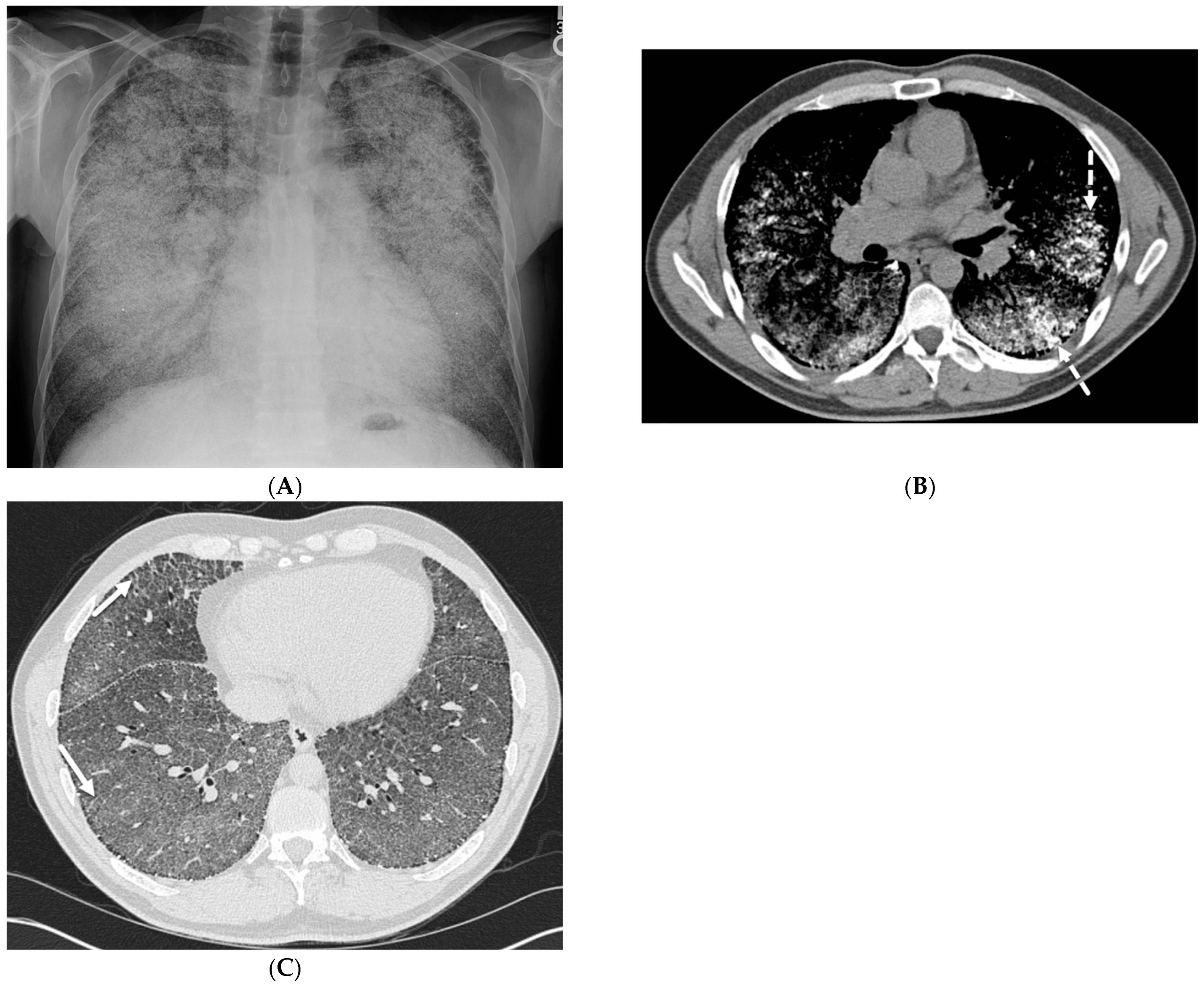 Tomography 10 00045 g017 Tomography 10 00045 g017