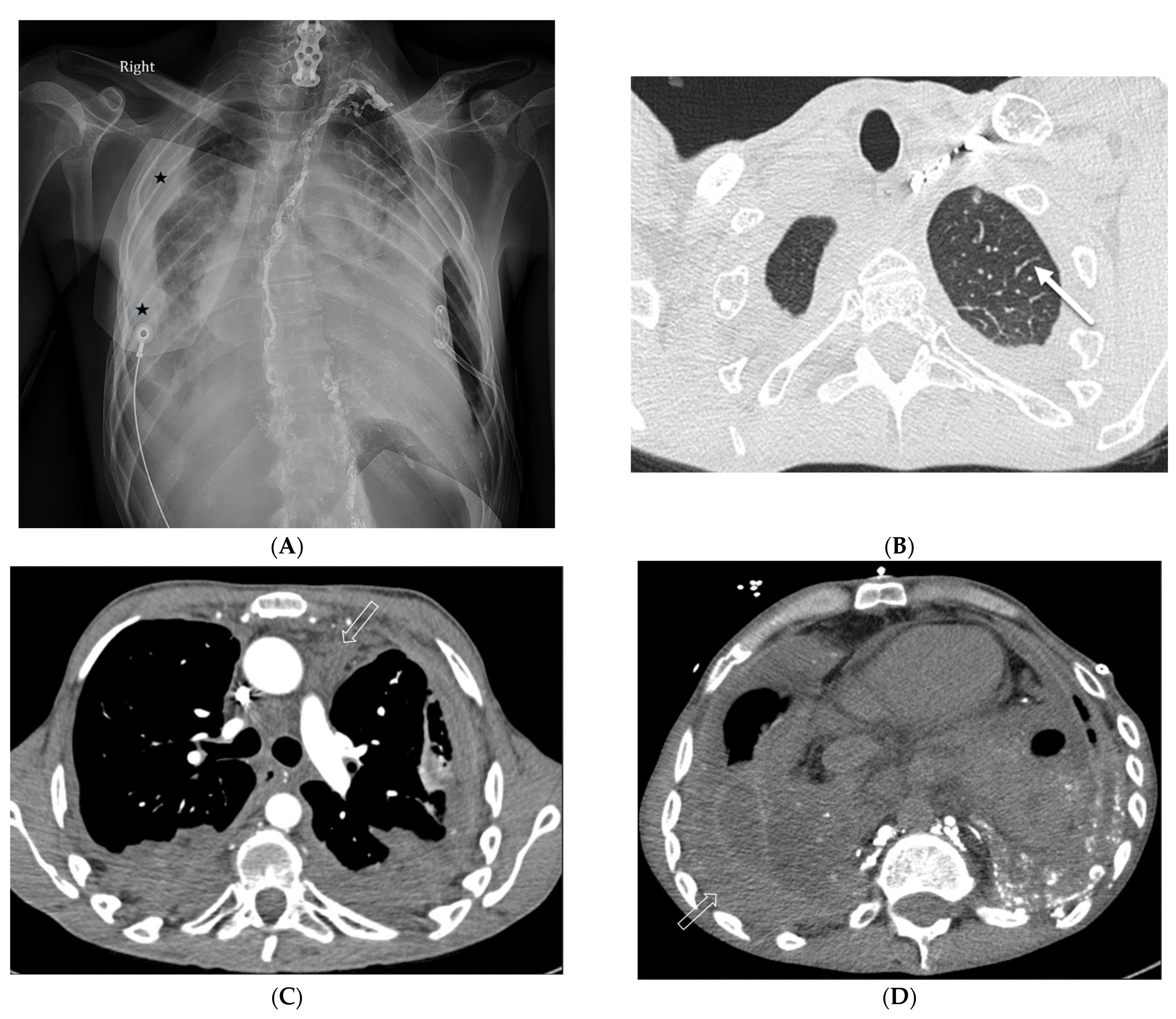 Tomography 10 00045 g019a Tomography 10 00045 g019a