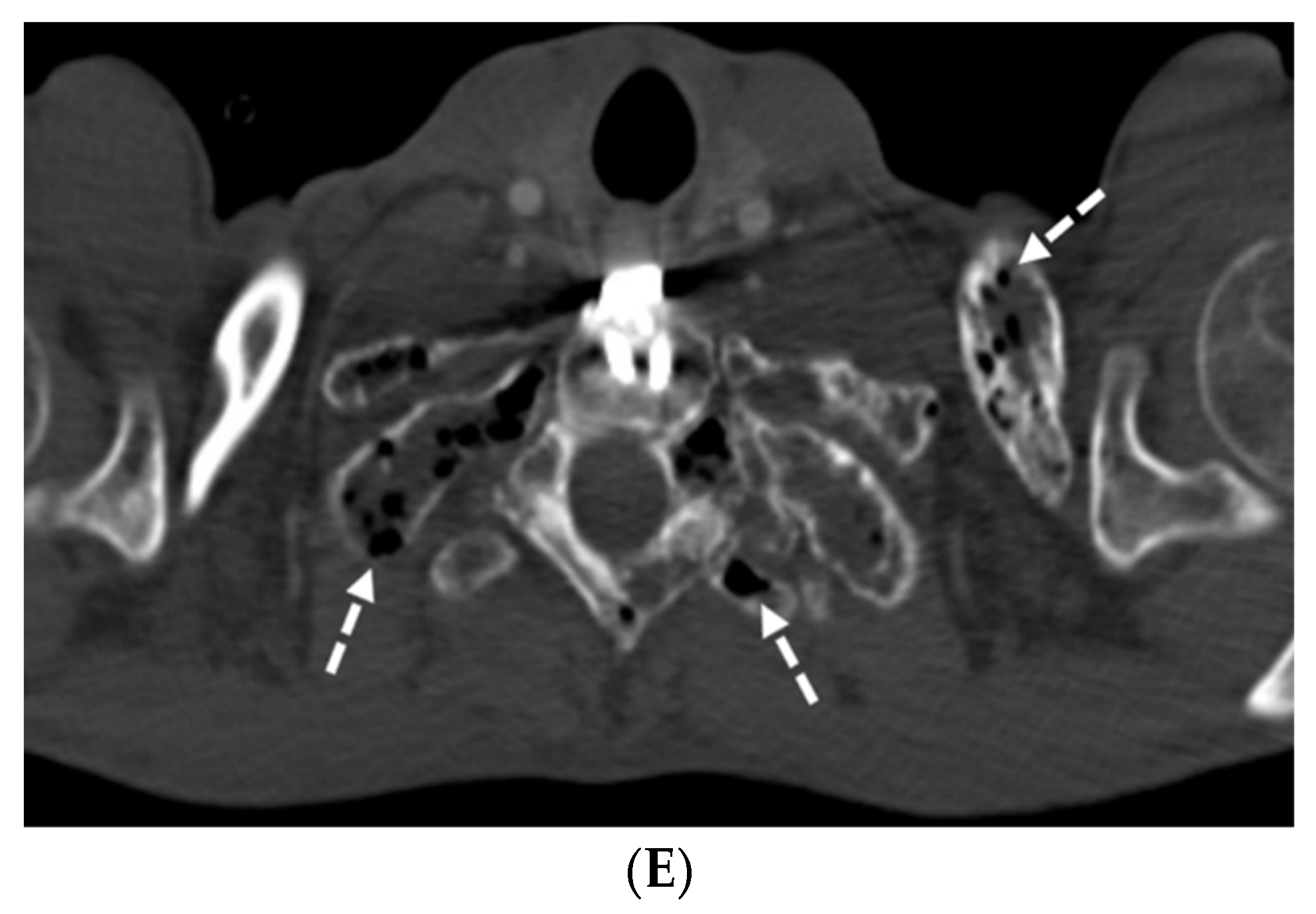 Tomography 10 00045 g019b Tomography 10 00045 g019b