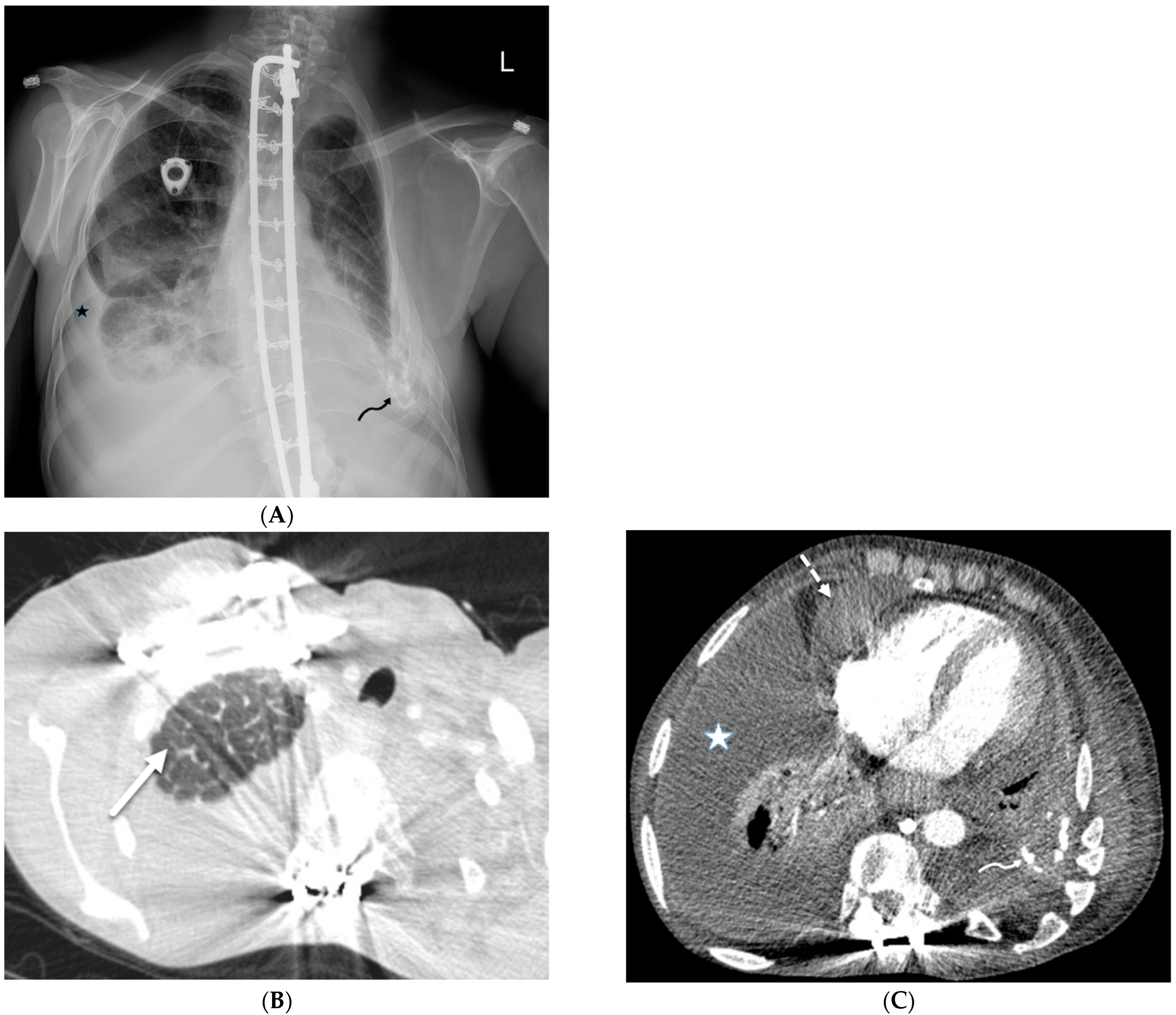 Tomography 10 00045 g020 Tomography 10 00045 g020