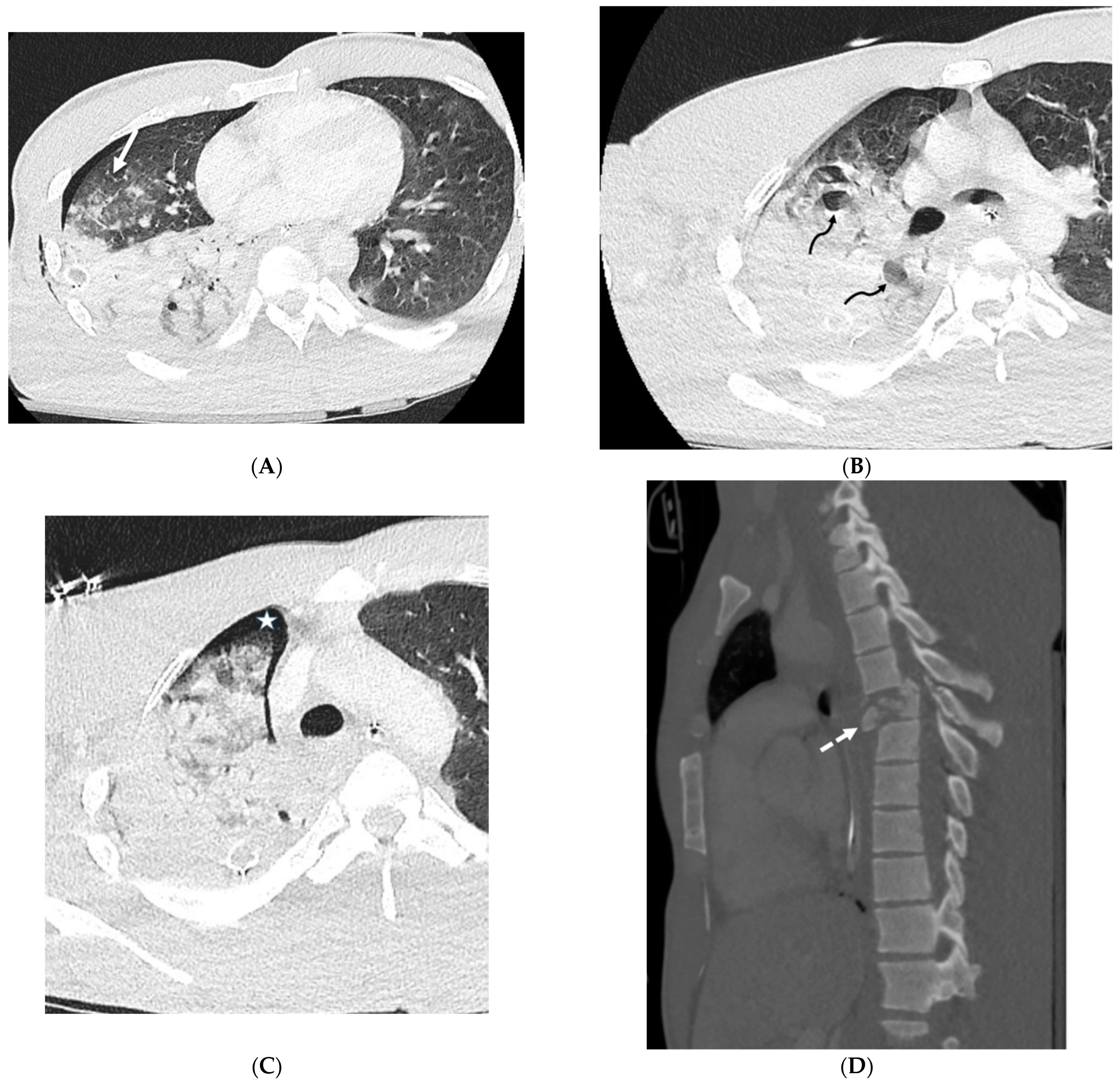 Tomography 10 00045 g021 Tomography 10 00045 g021