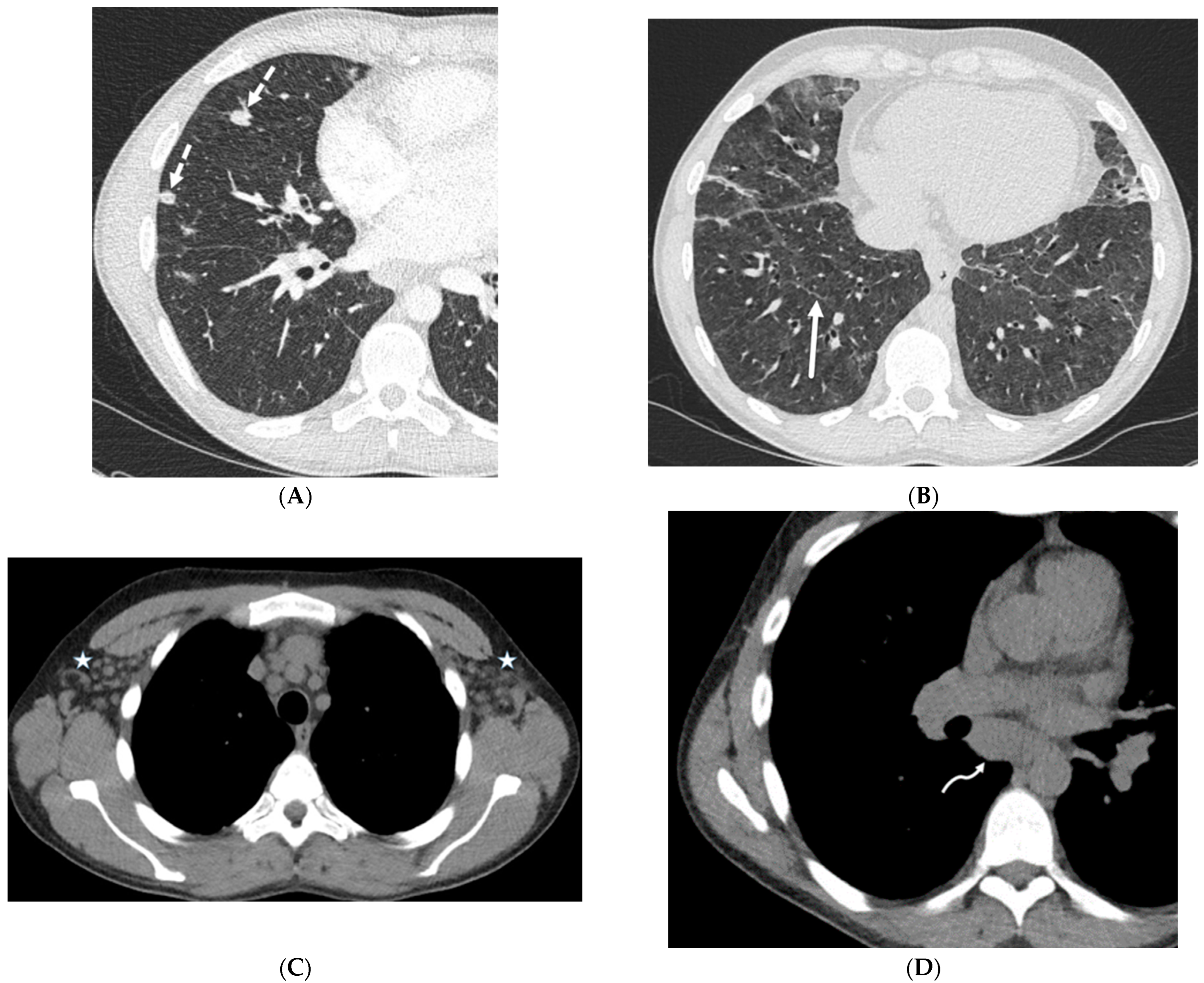 Tomography 10 00045 g022 Tomography 10 00045 g022