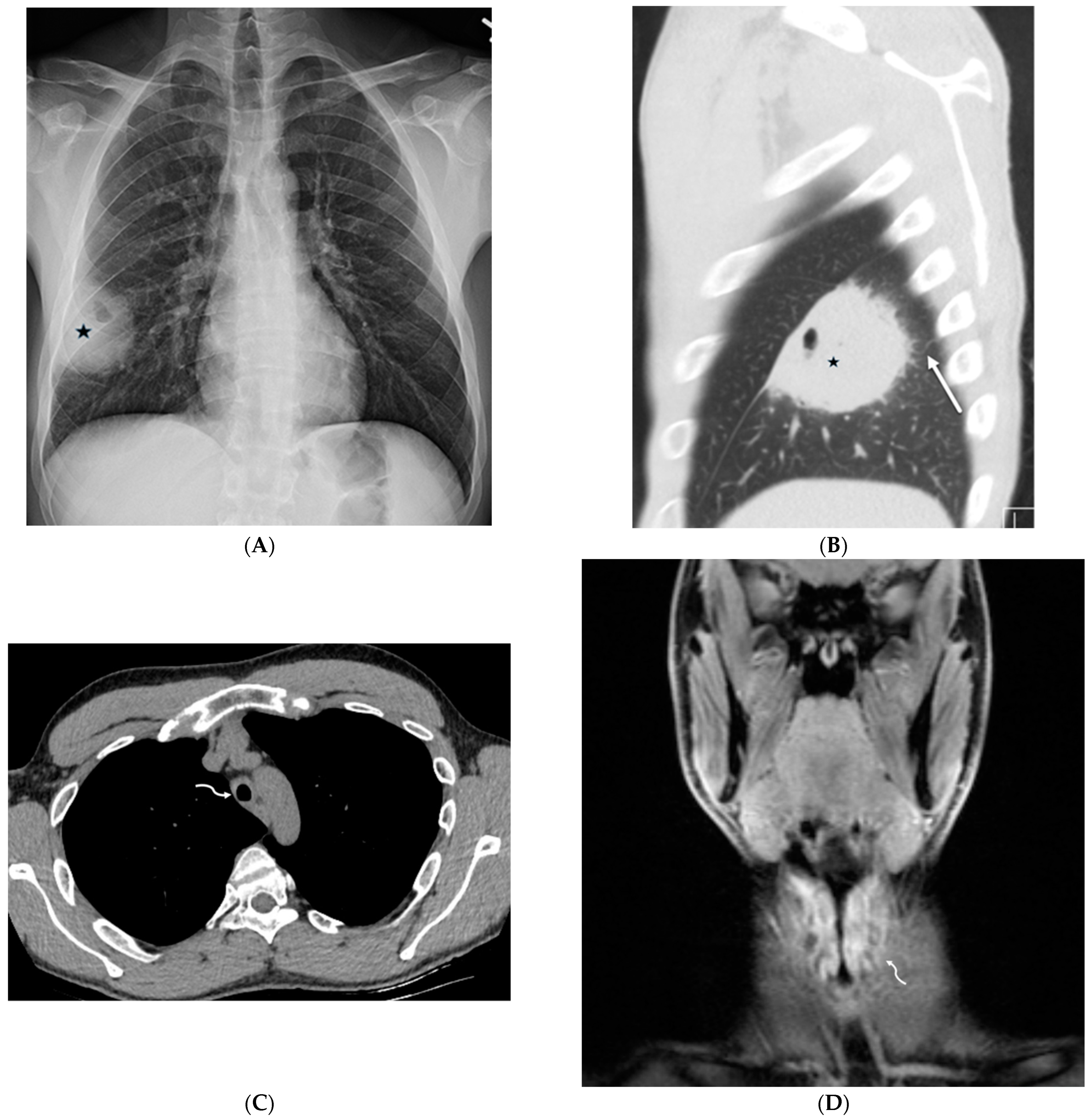 Tomography 10 00045 g023 Tomography 10 00045 g023
