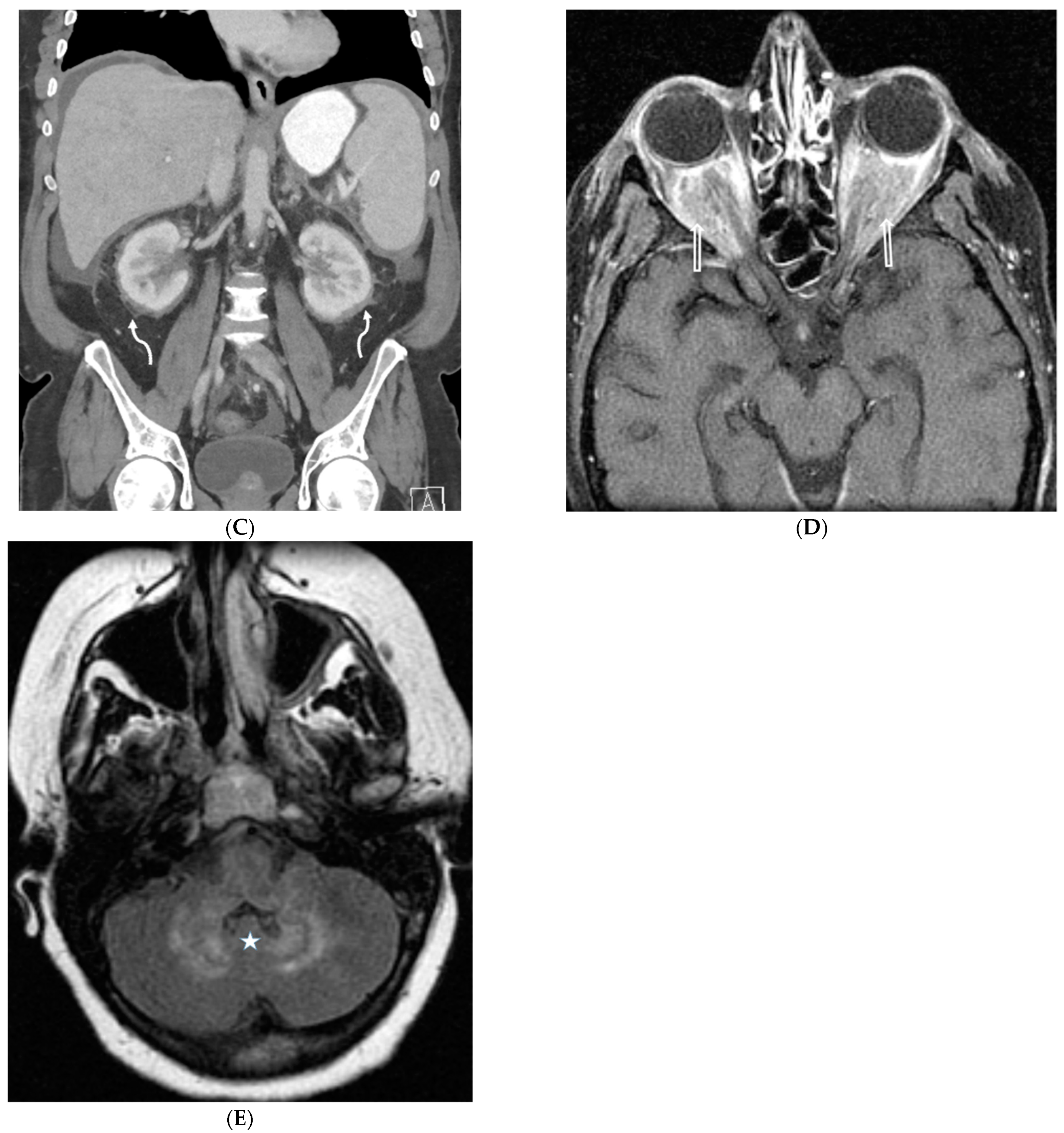 Tomography 10 00045 g024b Tomography 10 00045 g024b