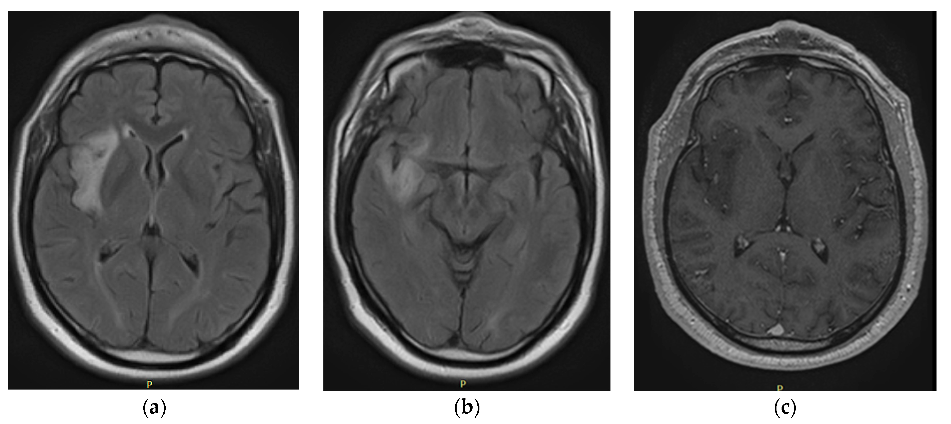 Tomography 10 00046 g001