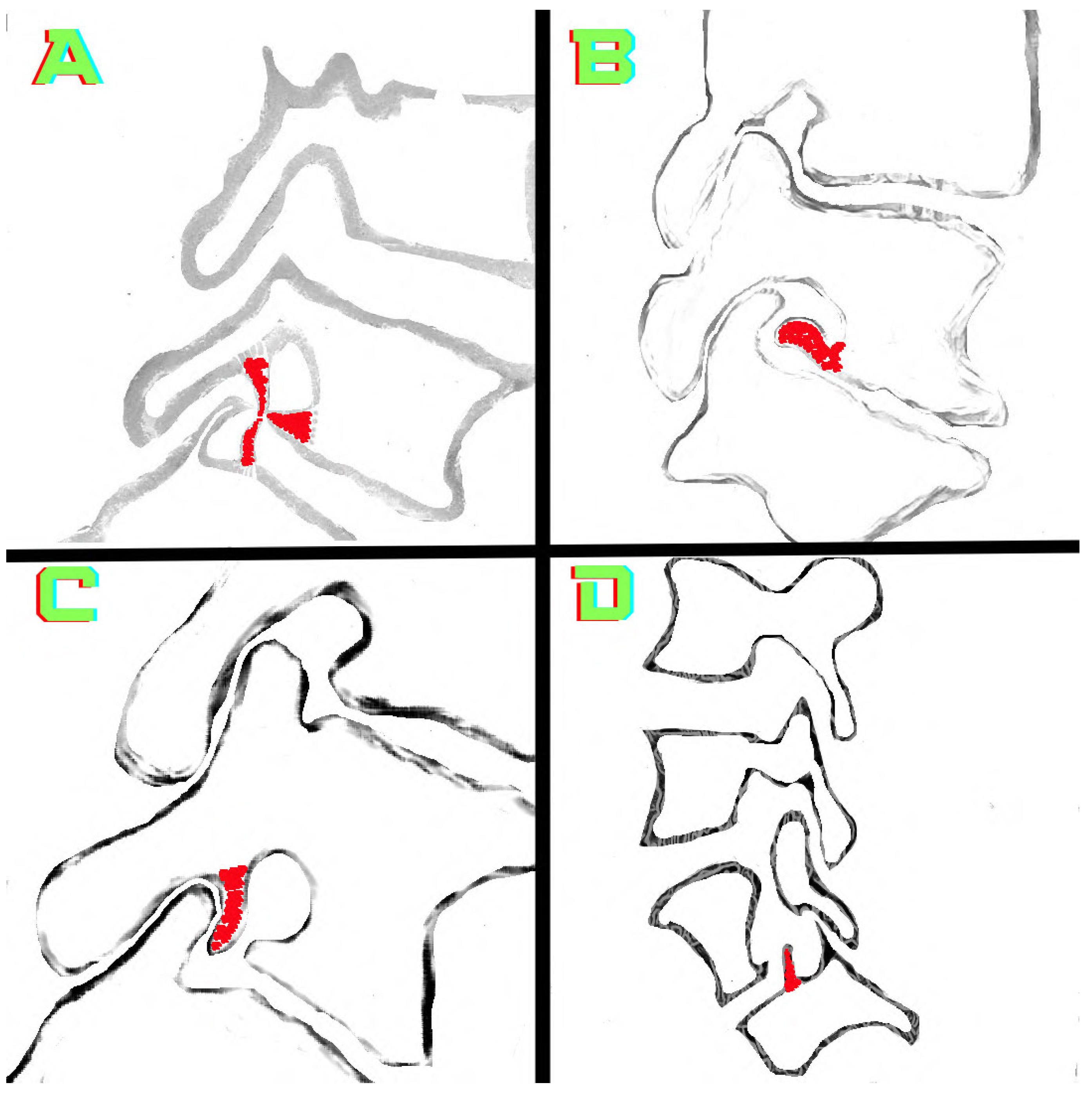 Tomography 10 00047 g004 Tomography 10 00047 g004