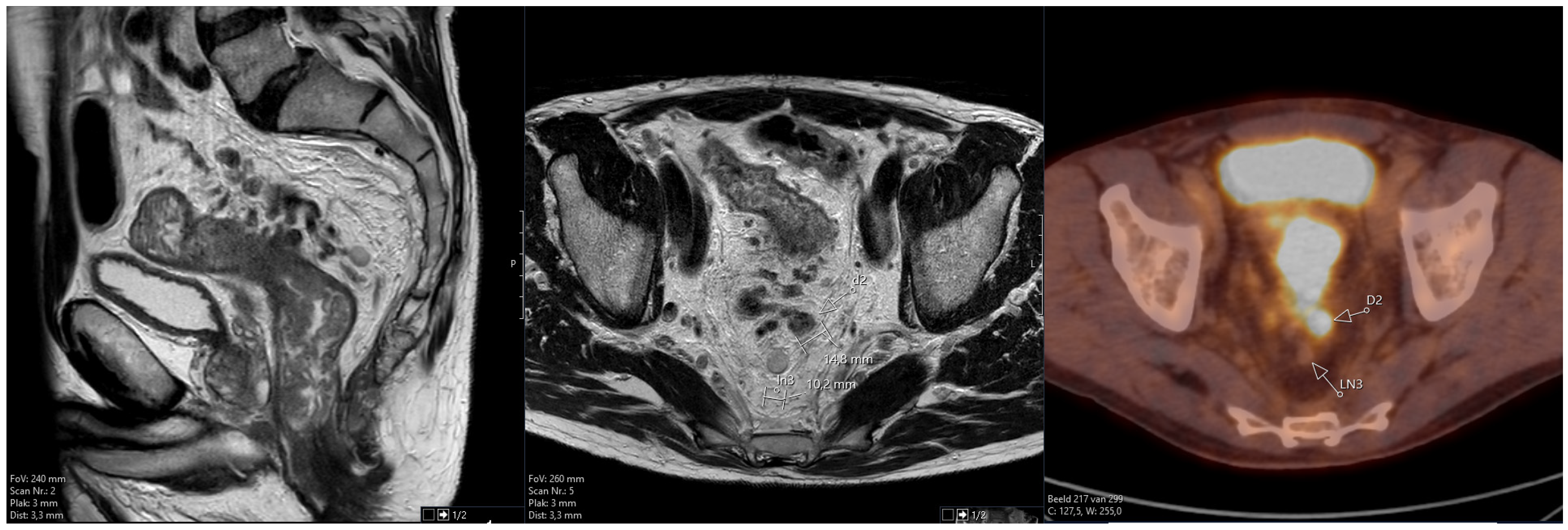 Tomography 10 00048 g001 Tomography 10 00048 g001