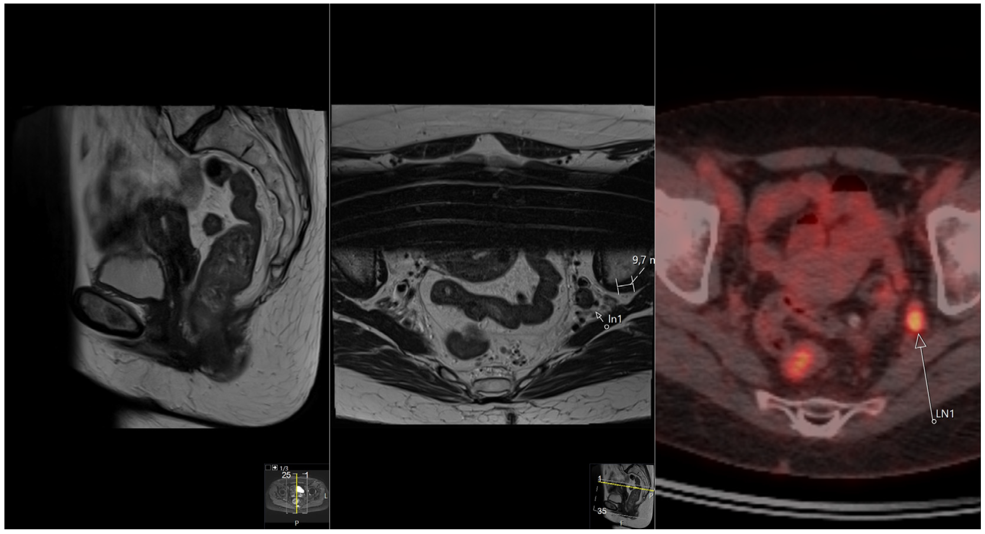 Tomography 10 00048 g003 Tomography 10 00048 g003