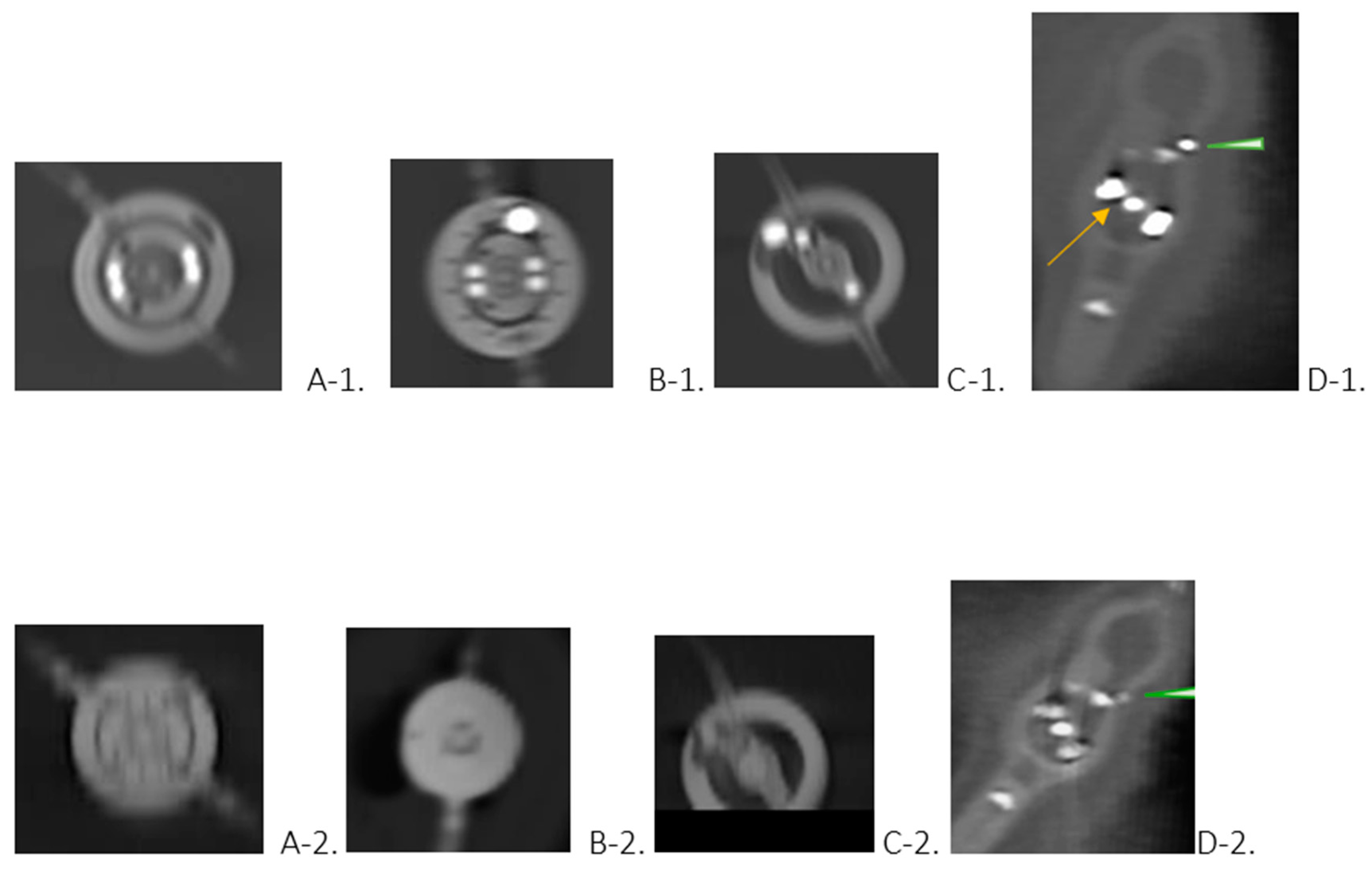 Tomography 10 00050 g001