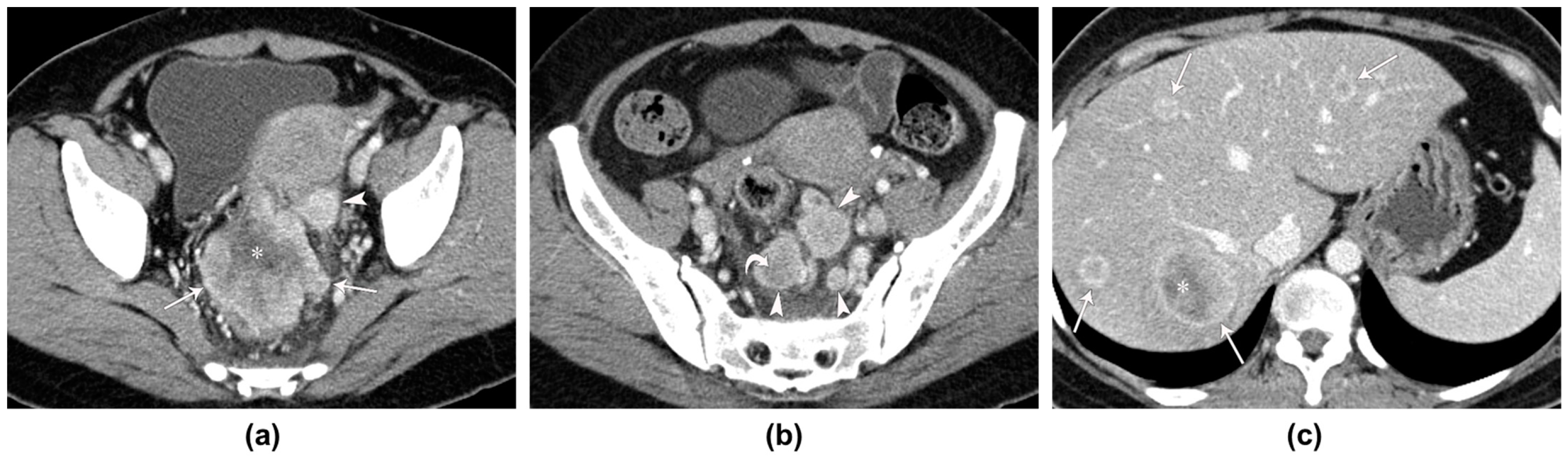 Tomography 10 00052 g003