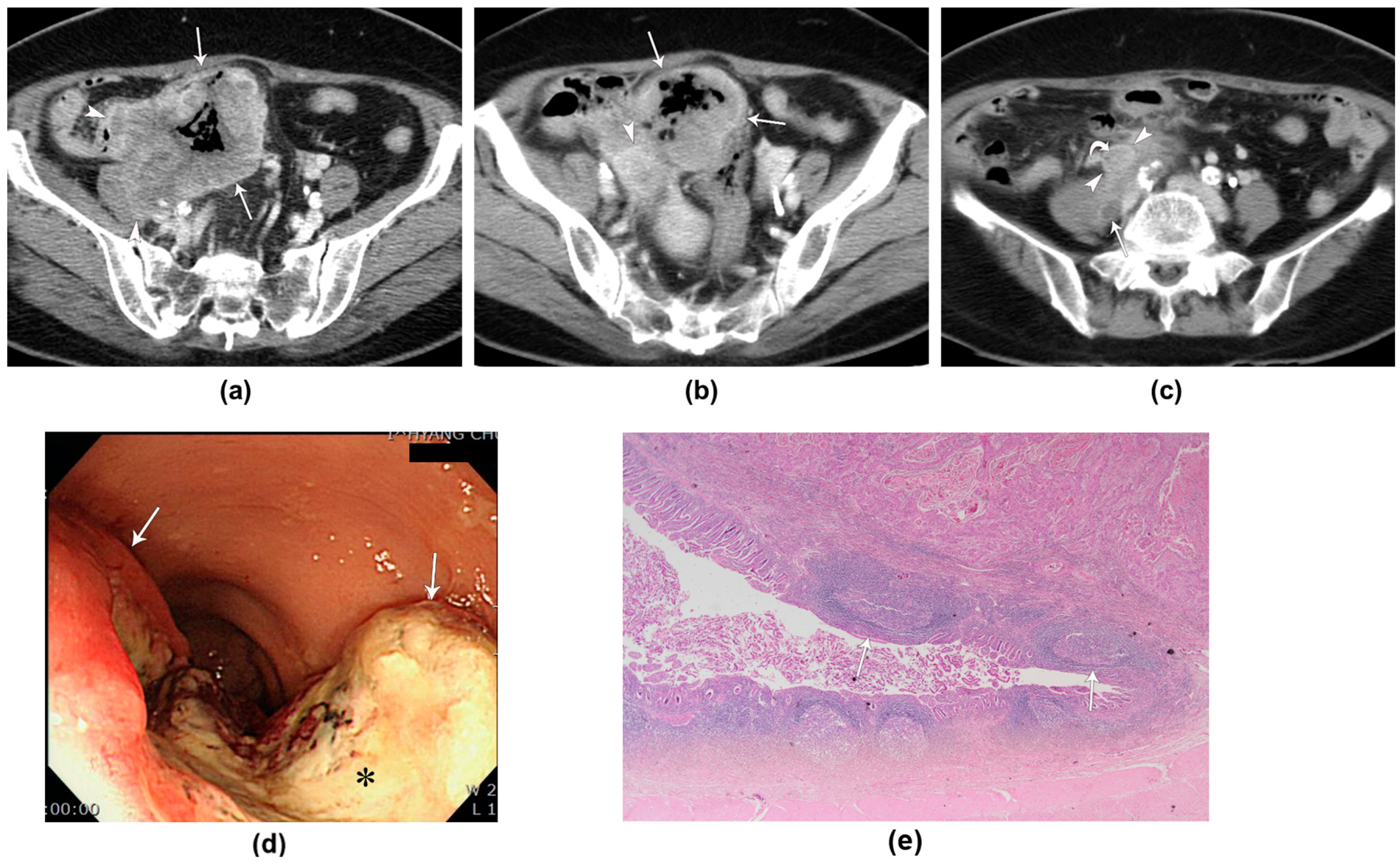 Tomography 10 00052 g004