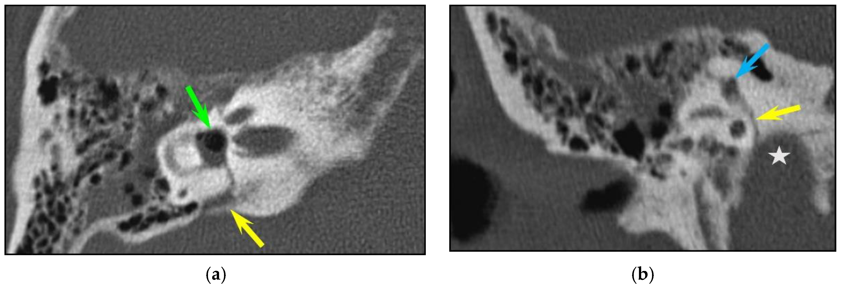 Tomography 10 00056 g001