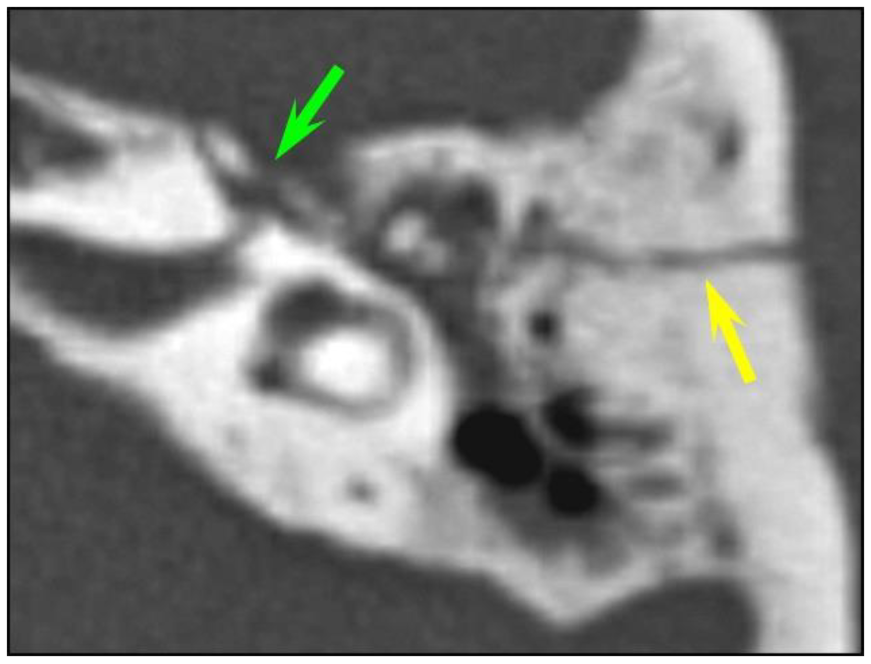 Tomography 10 00056 g002