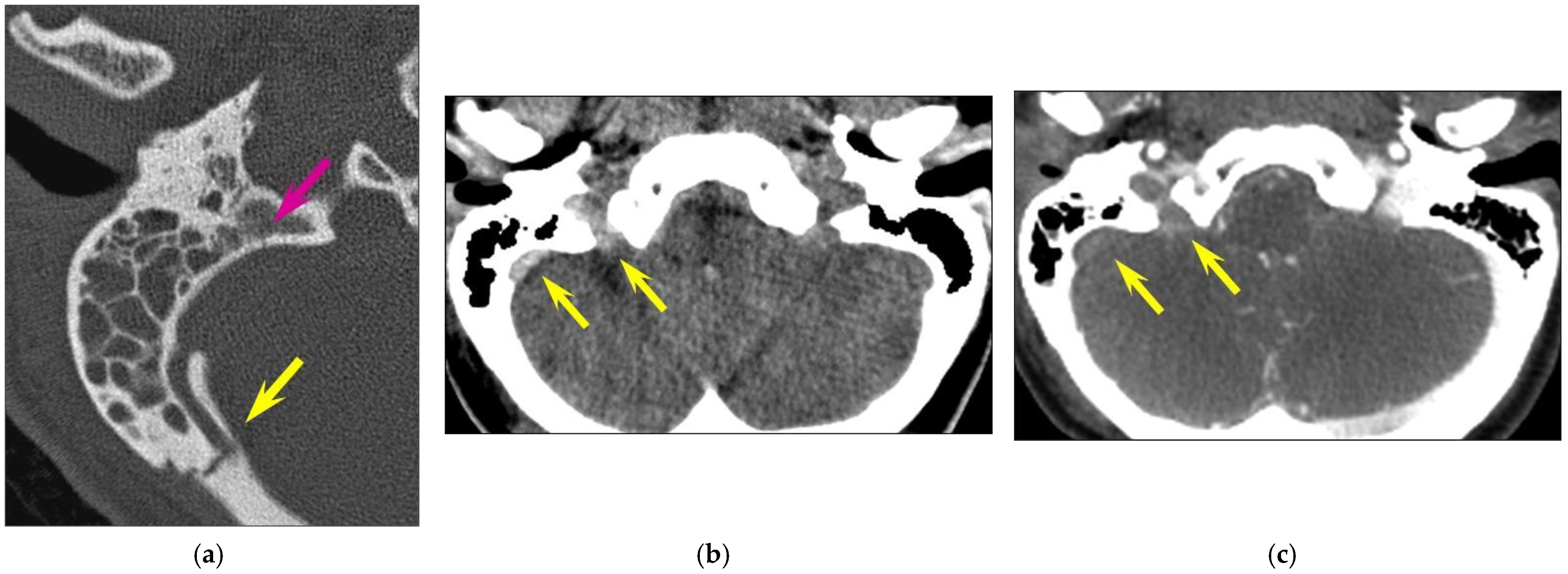 Tomography 10 00056 g004