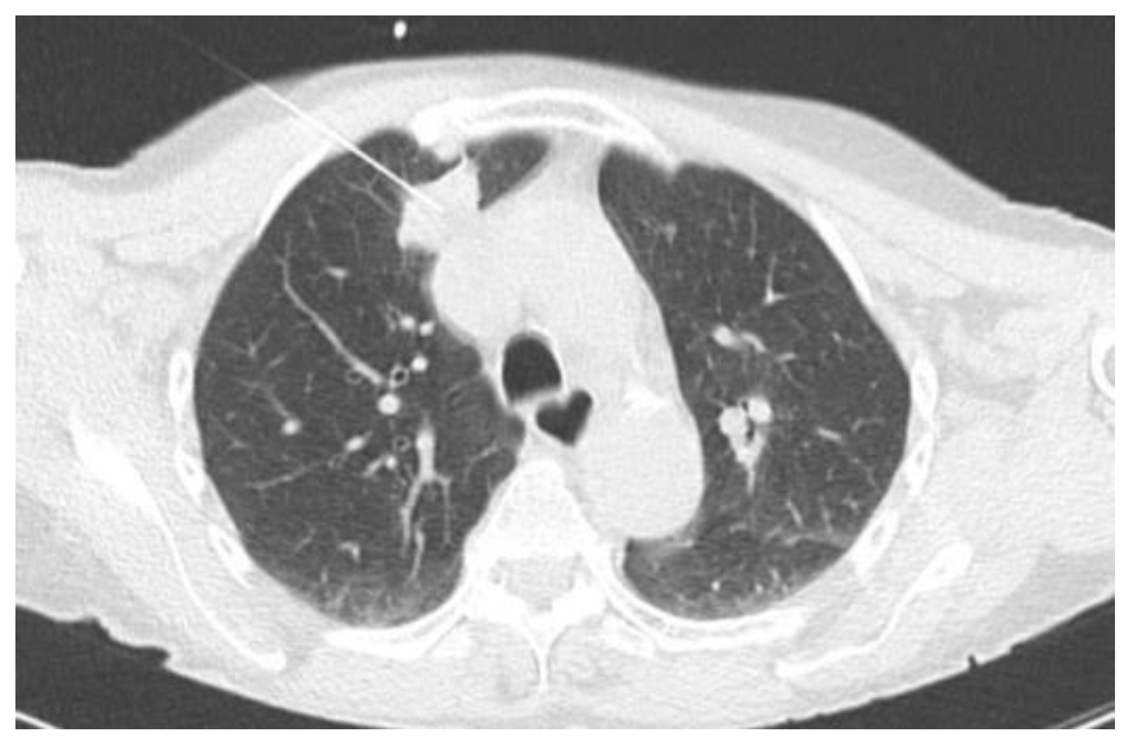 Tomography 10 00058 g001 Tomography 10 00058 g001