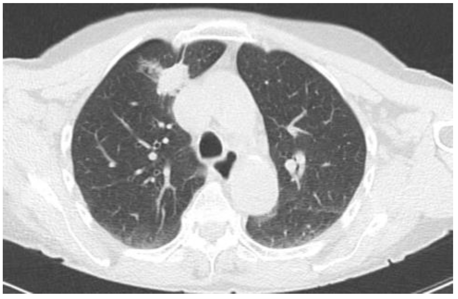 Tomography 10 00058 g003 Tomography 10 00058 g003