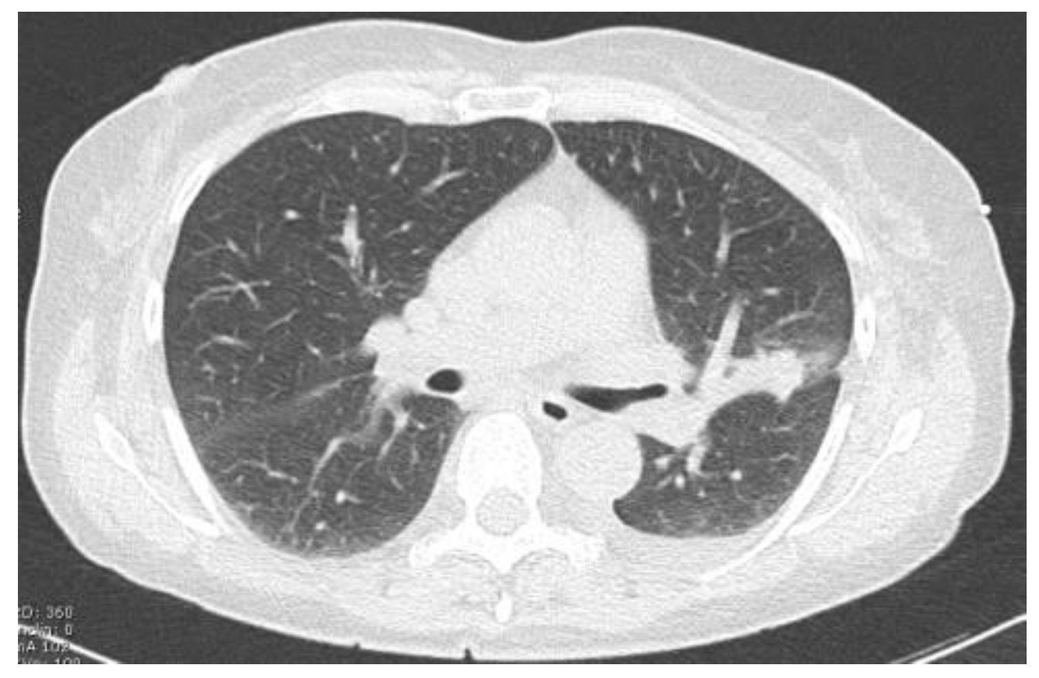 Tomography 10 00058 g004 Tomography 10 00058 g004
